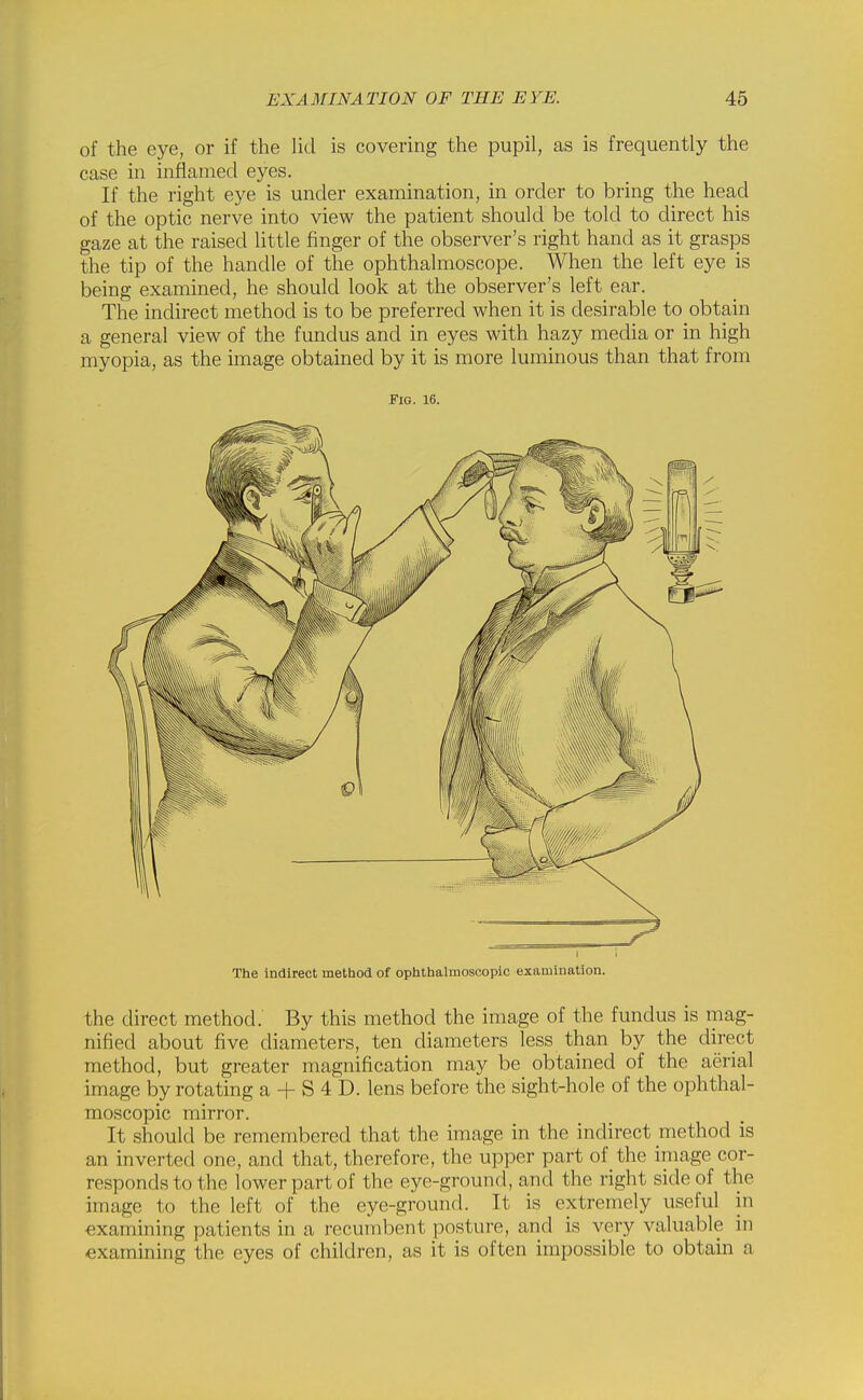 of the eye, or if the lid is covering the pupil, as is frequently the case in inflamed eyes. If the right eye is under examination, in order to bring the head of the optic nerve into view the patient should be told to direct his gaze at the raised little finger of the observer's right hand as it grasps the tip of the handle of the ophthalmoscope. When the left eye is being examined, he should look at the observer's left ear. The indirect method is to be preferred when it is desirable to obtain a general view of the fundus and in eyes with hazy media or in high myopia, as the image obtained by it is more luminous than that from Fig. 16. I i The indirect method of ophthalmoscopic examination. the direct method. By this method the image of the fundus is mag- nified about five diameters, ten diameters less than by the direct method, but greater magnification may be obtained of the aerial image by rotating a + S 4 D. lens before the sight-hole of the ophthal- moscopic mirror. It should be remembered that the image in the indirect method is an inverted one, and that, therefore, the upper part of the iniage cor- responds to the lower part of the eye-ground, and the right side of the image to the left of the eye-ground. It is extremely useful in examining patients in a recumbent posture, and is very valuable in examining the eyes of children, as it is often impossible to obtain a