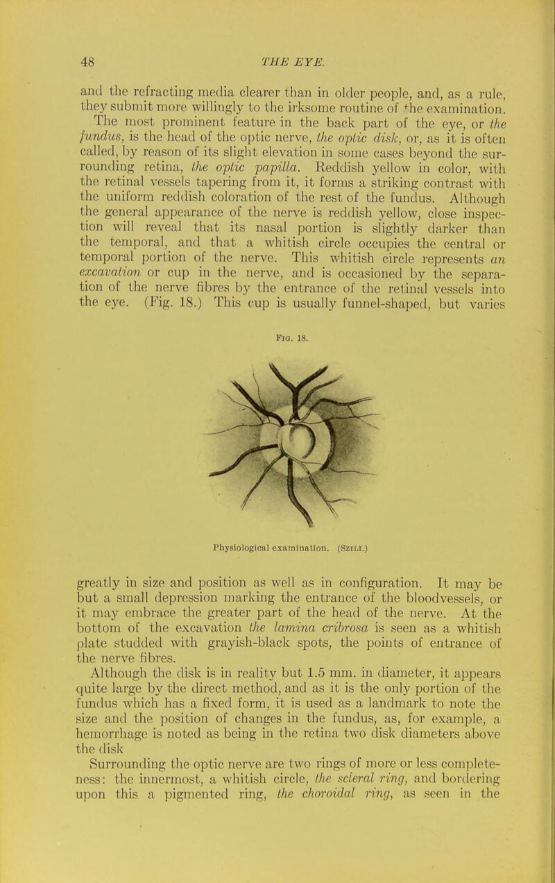 and the refracting media clearer than in older people, and, as a rule, they submit more willingly to the irksome routine of *^^he examination. The most prominent feature in the back part of the eye, or the fundus, is the head of the optic nerve, the optic disk, or, as it is often called, by reason of its slight elevation in some cases beyond the sur- rounding retina, iJie optic papilla. Reddish yellow in color, with the retinal vessels tapering from it, it forms a striking contrast with the uniform reddish coloration of the rest of the fundus. Although the general appearance of the nerve is reddish yellow, close inspec- tion will reveal that its nasal portion is slightly darker than the temporal, and that a whitish circle occupies the central or tempoi-al portion of the nerve. This whitish circle represents an excavation or cup in the nerve, and is occasioned by the separa- tion of the nerve fibres by the entrance of the retinal vessels into the eye. (Fig. 18.) This cup is usually funnel-shaped, but varies greatly in size and position as well as in configuration. It may be but a small depression marking the entrance of the bloodvessels, or it may embrace the greater part of the head of the nerve. At the bottom of the excavation the lamina cribrosa is seen as a whitish plate studded with grayish-black spots, the points of entrance of the nerve fibres. Although the disk is in reality but 1.5 mm. in diameter, it appears quite large by the direct method, and as it is the only portion of the fundus which has a fixed form, it is used as a landmark to note the size and the position of changes in the fundus, as, for example, a hemorrhage is noted as being in the retina two disk diameters above the disk Surrounding the optic nerve are two rings of more or less complete- ness: the innermost, a whitish circle, the scleral ring, and bordering upon this a pigmented ring, the choroidal ring, as seen in the Fig. 18. Physiological examination. (Szn,i.)