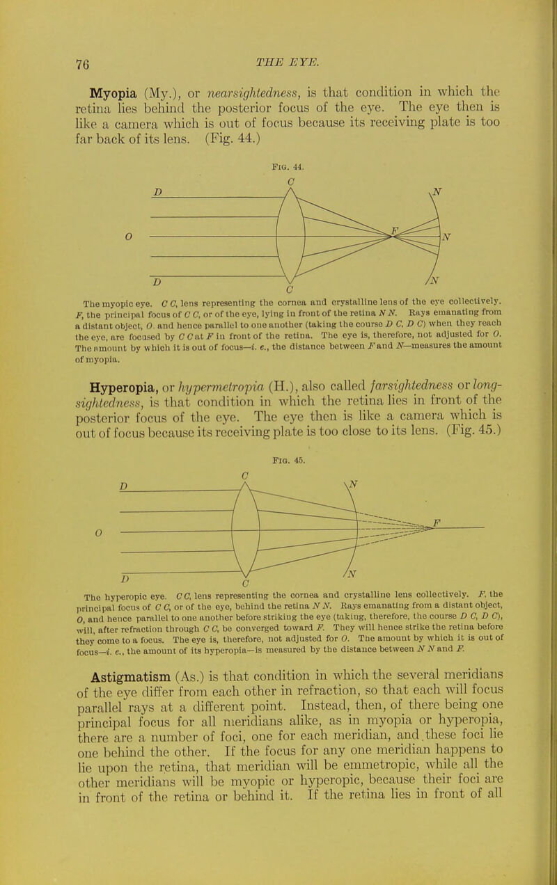 Myopia (My.), or nearsightedness, is that condition in which the retina hes behind the posterior focus of the eye. The eye then is like a camera which is out of focus because its receiving plate is too far back of its lens. (Fig. 44.) Fig. 44. 0 The myopic eye. CC, lens representing the cornea and crystalline lens of the eye collectively. J?, the principal focus of C C, or of the eye, lying in front of the retina JtfJV. Rays emanating from a distant object, 0. and hence parallel to one another (Uking the course D C. D C) when they reach the eye, are focused by C Cat Ji in front of the retina. The eye is, therefore, not adjusted for O. The amount by which it is out of focus—(. e., the distance between J and .ZV—measures the amount of myopia. Hyperopia, or hyperjnetropia (H.), also called farsightedness orlong- sightcdne.ss, is that condition in which the retina lies in front of the posterior focus of the eye. The eye then is like a camera which is out of focus because its receiving plate is too close to its lens. (Fig. 45.) Fia. 45. 0 The hyperopic eye. CC, lens representing the cornea and crystalline lens collectively. F. the principal focus of C C, or of the eye, behind the retina iVxV. Rays emanating from a distant object, 0, and hence parallel to one another before striking the eye (taking, therefore, the course D C, D C), will, after refraction through C C, be converged toward F. They will hence strike the retina before they come to a focus. The eye is, therefore, not adjusted for 0. The amount by which it is out of focus—i. e., the amount of its hyperopia—is measured by the distance between iViVand F. Astigmatism (As.) is that condition in which the several meridians of the eye differ from each other in refraction, so that each will focus parallel rays at a different point. Instead, then, of there being oiie principal focus for all meridians alike, as in myopia or hyperopia, there are a number of foci, one for each meridian, and.these foci lie one behind the other. If the focus for any one meridian happens to lie upon the retina, that meridian will be emmetropic, while all the other meridians will be myopic or hyperopic, because their foci are in front of the retina or behind it. If the retina lies in front of all