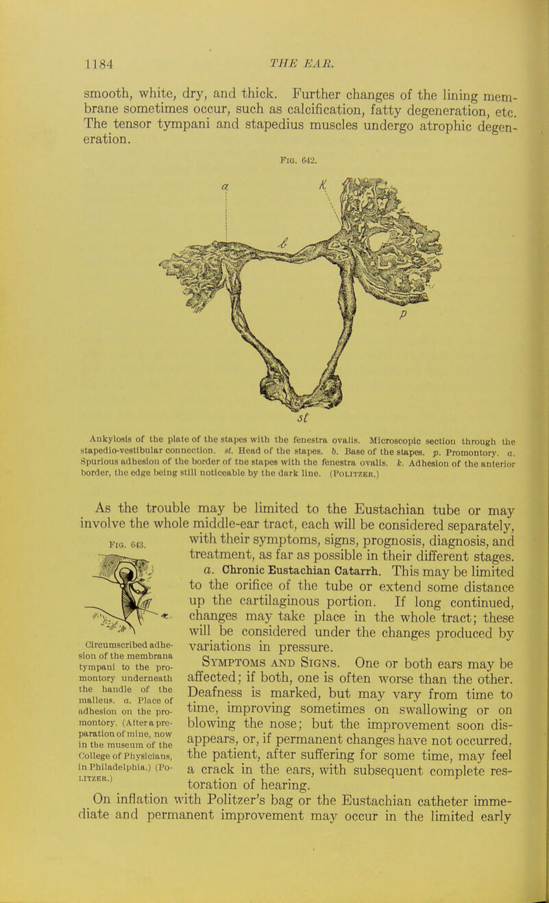 smooth, white, dry, and thick. Further changes of the lining mem- brane sometimes occur, such as calcification, fatty degeneration, etc. The tensor tympani and stapedius muscles undergo atrophic degen- eration. Fig. 642. St Ankylosis of tho plate of the stapes with the fenestra ovalis. Microscopic section through the stapcdio-vestlbular connection, gt. Head of the stapes. 6. Base of the stapes, p. Promontory, a. Spurious adhesion of the border of the stapes with the fenestra ovalis. k. Adhesion of the anterior border, the edge being still noticeable by the dark line. (Politzer.) Fig, 648. As the trouble may be limited to the Eustachian tube or may involve the whole middle-ear tract, each will be considered separately, with their symptoms, signs, prognosis, diagnosis, and treatment, as far as possible in their different stages. a. Chronic Eustachian Catarrh. This may be limited to the orifice of the tube or extend some distance up the cartilaginous portion. If long continued, changes may take place in the whole tract; these will be considered under the changes produced by variations in pressure. Symptoms and Signs. One or both ears may be affected; if both, one is often worse than the other. Deafness is marked, but may vary from time to time, improving sometimes on swallowing or on blowing the nose; but the improvement soon dis- appears, or, if permanent changes have not occurred, the patient, after suffering for some time, may feel a crack in the ears, with subsequent complete res- toration of hearing. On inflation with Politzer's bag or the Eustachian catheter imme- diate and permanent improvement may occur in the limited early Circumscribed adhe- sion of the membrana tympani to the pro- montory underneath the handle of the malleus, a. Place of adhesion on the pro- montory. (Altera pre- paration of mine, now in the museum of the College of Physicians, in Philadelphia.) (Po- I.ITZER.)