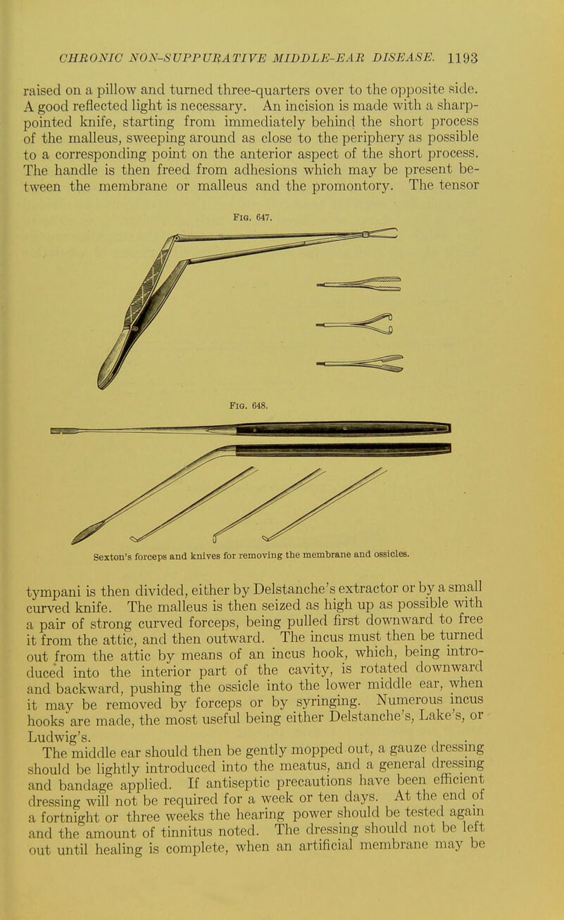 raised on a pillow and turned three-quarters over to the opposite side. A good reflected light is necessary. An incision is made with a sharp- pointed knife, starting from immediately behind the short process of the malleus, sweeping around as close to the periphery as possible to a corresponding point on the anterior aspect of the short process. The handle is then freed from adhesions which may be present be- tween the membrane or malleus and the promontory. The tensor Fig. 647. Sexton's forceps and knives for removing tbe membrane and ossicles. tympani is then divided, either by Delstanche's extractor or by a small curved knife. The malleus is then seized as high up as possible with a pair of strong curved forceps, being pulled first downward to free it from the attic, and then outward. The incus must then be turned out from the attic by means of an incus hook, which, being intro- duced into the interior part of the cavity, is rotated downward and backward, pushing the ossicle into the lower middle ear, when it may be removed by forceps or by syringing. Numerous incus hooks are made, the most useful being either Delstanche's, Lake's, or Ludwig's. The middle ear should then be gently mopped out, a gauze dressing- should be lightly introduced into the meatus, and a general dressing and bandage applied. If antiseptic precautions have been efficient dressing will not be required for a week or ten days. At the end of a fortnight or three weeks the hearing power should be tested again and the amount of tinnitus noted. The dressing should not be left out until healing is complete, when an artificial membrane may be