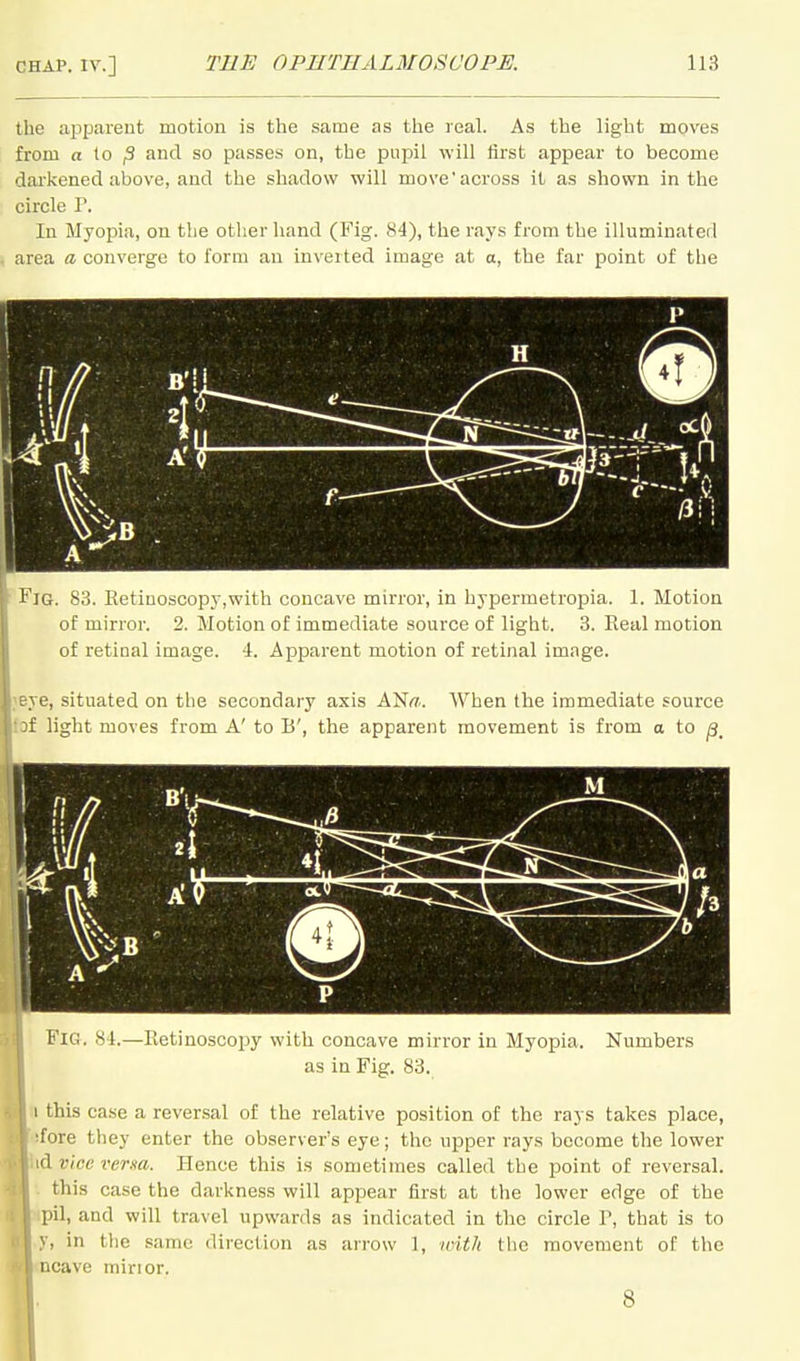 the appareut motion is the same as the real. As the light moves from n (o ^ and so passes on, the pupil will first appear to become dai'kened above, and the shadow will move across it as shown in the circle P. In Myopia, on the otlier hand (Fig. 84), the rays from the illuminated area a converge to form an inverted image at a, the far point of the 1 IG. 83. Ketinoscopy,with concave mirror, in hypermetropia. 1. Motion of mirror. 2. Motion of immediate source of light. 3. Real motion of retinal image. 4. Apparent motion of retinal image. e, situated on the secondary axis ANiy.. When the immediate source f light moves from A' to B', the apparent movement is from a to ^, Fig. 84.—Ketinoscopy with concave mirror in Myopia. Numbers as in Fig. 83. 1 this case a reversal of the relative position of the rays takes place, fore they enter the observer's eye; the upper rays become the lower d Vice verm. Hence this is sometimes called the point of reversal, this case the darkness will appear first at the lower edge of the pil, and will travel upwards as indicated in the circle V, that is to V, in the same direction as arrow 1, nnth tiie movement of the iicave minor. 8