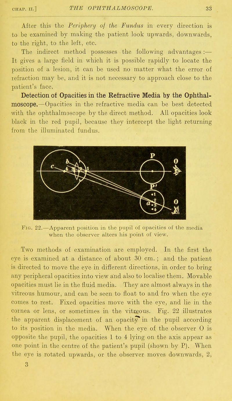 After this the Periphery of the Fundus in every direction is to be examined by making the patient look upwards, downwards, to the right, to the left, etc. The indirect method possesses the following advantages :— It gives a large field in which it is possible rapidly to locate the position of a lesion, it can be used no matter what the error of refraction may be, and it is not necessary to approach close to the patient's face. Detection of Opacities in the Refractive Media by the Ophthal- moscope.—Opacities in the refractive media can be best detected with the ophthalmoscope by the direct method. All opacities look black in the red pupil, because they intercept the light returning from the illuminated fundus. p (-^ \ A 0 Vil Fig. 22.—Apparent position in the pupil of opacities of the media when the observer alters his point of view. Two methods of examination are employed. In the first the eye is examined at a distance of about 30 cm. ; and the patient is directed to move the eye in different directions, in order to bring any peripheral opacities into view and also to localise them. Movable opacities must lie in the fluid media. They are almost always in the vitreous humour, and can be seen to float to and fro when the eye comes to rest. Fixed opacities move with the eye, and lie in the cornea or lens, or sometimes in the vrtaeous. Fig. 22 illustrates the apparent displacement of an opacity in the pupil according to its position in the media. When the eye of the observer 0 is opposite the pupil, the opacities 1 to 4 lying on the axis appear as one point in the centre of the patient's pupil (shown by P). When the eye is rotated upwards, or the observer moves downwards, 2, 3