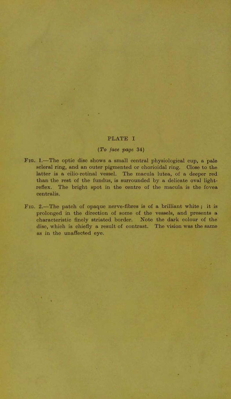 (To face page 34) Fio. 1.—The optic disc shows a small central physiological cup, a pale scleral ring, and an outer pigmented or chorioidal ring. Close to the latter is a cilio-retinal vessel. The macula Intra, of a deeper red than the rest of the fundus, is surrounded by a delicate oval light- reflex. The bright spot in the centre of the macula is the fovea centralis. Fio. 2.—The patch of opaque nerve-fibres is of a brilliant white ; it is prolonged in the direction of some of the vessels, and presents a characteristic finely striated border. Note the dark colour of the disc, which is chiefly a result of contrast. The vision was the same as in the unaffected eye.