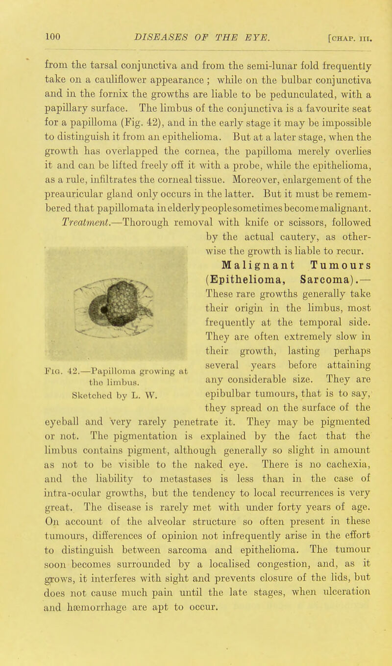 from the tarsal conjunctiva and from the semi-lunar fold frequently take on a cauliflower appearance ; while on the bulbar conjunctiva and in the fornix the growths are liable to be pedunculated, with a papillary surface. The limbus of the conjunctiva is a favourite seat for a papilloma (Fig. 42), and in the early stage it may be impossible to distinguish it from an epithelioma. But at a later stage, when the growth has overlapped the cornea, the papilloma merely overlies it and can be lifted freely off it with a probe, while the epithelioma, as a rule, infiltrates the corneal tissue. Moreover, enlargement of the preauricular gland only occurs in the latter. But it must be remem- bered that papillomata inelderlypeoplesometimesbecomemalignant. Treatment.—Thorough removal with knife or scissors, followed by the actual cautery, as other- wise the growth is liable to recur. Malignant Tumours (Epithelioma, Sarcoma).— These rare growths generally take their origin in the limbus, most frequently at the temporal side. They are often extremely slow in their growth, lasting perhaps several years before attaining Fig. 42.—Papilloma growing at / ° tho limbus. anv considerable size. They are Sketched by L. W. epibulbar tumours, that is to say, they spread on the surface of the eyeball and very rarely penetrate it. They may be pigmented or not. The pigmentation is explained by the fact that the limbus contains pigment, although generally so slight in amount as not to be visible to the naked eye. There is no cachexia, ami the liability to metastases is less than in the case of intra-ocular growths, but the tendency to local recurrences is very great. The disease is rarely met with under forty years of age. Oil account of the alveolar structure so often present in these tumours, differences of opinion not infrequently arise in the effort to distinguish between sarcoma and epithelioma. The tumour soon becomes surrounded by a localised congestion, and, as it grows, it interferes with sight and prevents closure of the lids, but does not cause much pain until the late stages, when ulceration and hsemoxrhage are apt to occur.