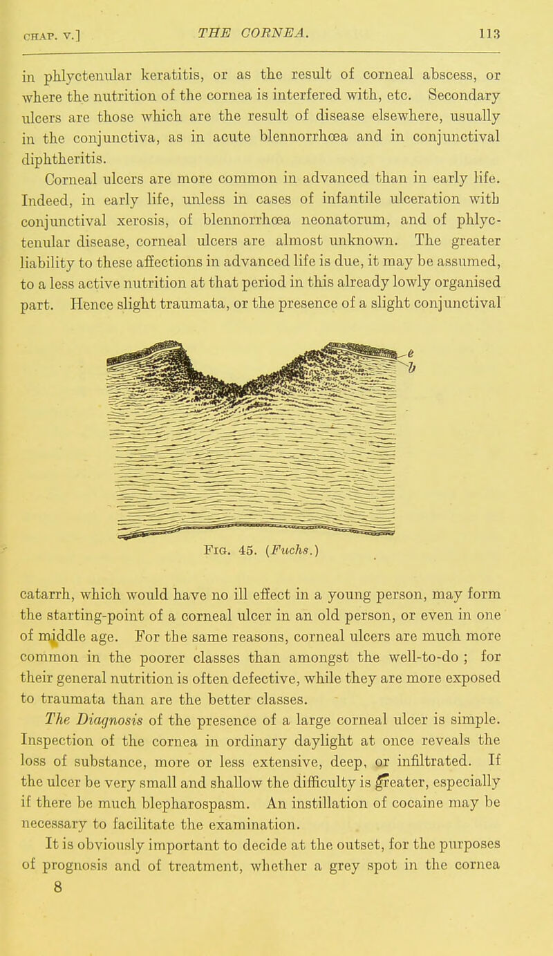 in phlyctenular keratitis, or as the result of corneal abscess, or where the nutrition of the cornea is interfered with, etc. Secondary ulcers are those which are the result of disease elsewhere, usually in the conjunctiva, as in acute blennorrhoea and in conjunctival diphtheritis. Corneal ulcers are more common in advanced than in early life. Indeed, in early life, unless in cases of infantile ulceration with conjunctival xerosis, of blennorrhoea neonatorum, and of phlyc- tenular disease, corneal ulcers are almost unknown. The greater liability to these affections in advanced life is due, it may be assumed, to a less active nutrition at that period in this already lowly organised part. Hence slight traumata, or the presence of a slight conjunctival Fig. 45. (Fuchs.) catarrh, which would have no ill effect in a young person, may form the starting-point of a corneal ulcer in an old person, or even in one of middle age. Fox the same reasons, corneal ulcers are much more common in the poorer classes than amongst the well-to-do ; for their general nutrition is often defective, while they are more exposed to traumata than are the better classes. The Diagnosis of the presence of a large corneal ulcer is simple. Inspection of the cornea in ordinary daylight at once reveals the loss of substance, more or less extensive, deep, or infiltrated. If the ulcer be very small and shallow the difficulty is greater, especially if there be much blepharospasm. An instillation of cocaine may be necessary to facilitate the examination. It is obviously important to decide at the outset, for the purposes of prognosis and of treatment, whether a grey spot in the cornea 8
