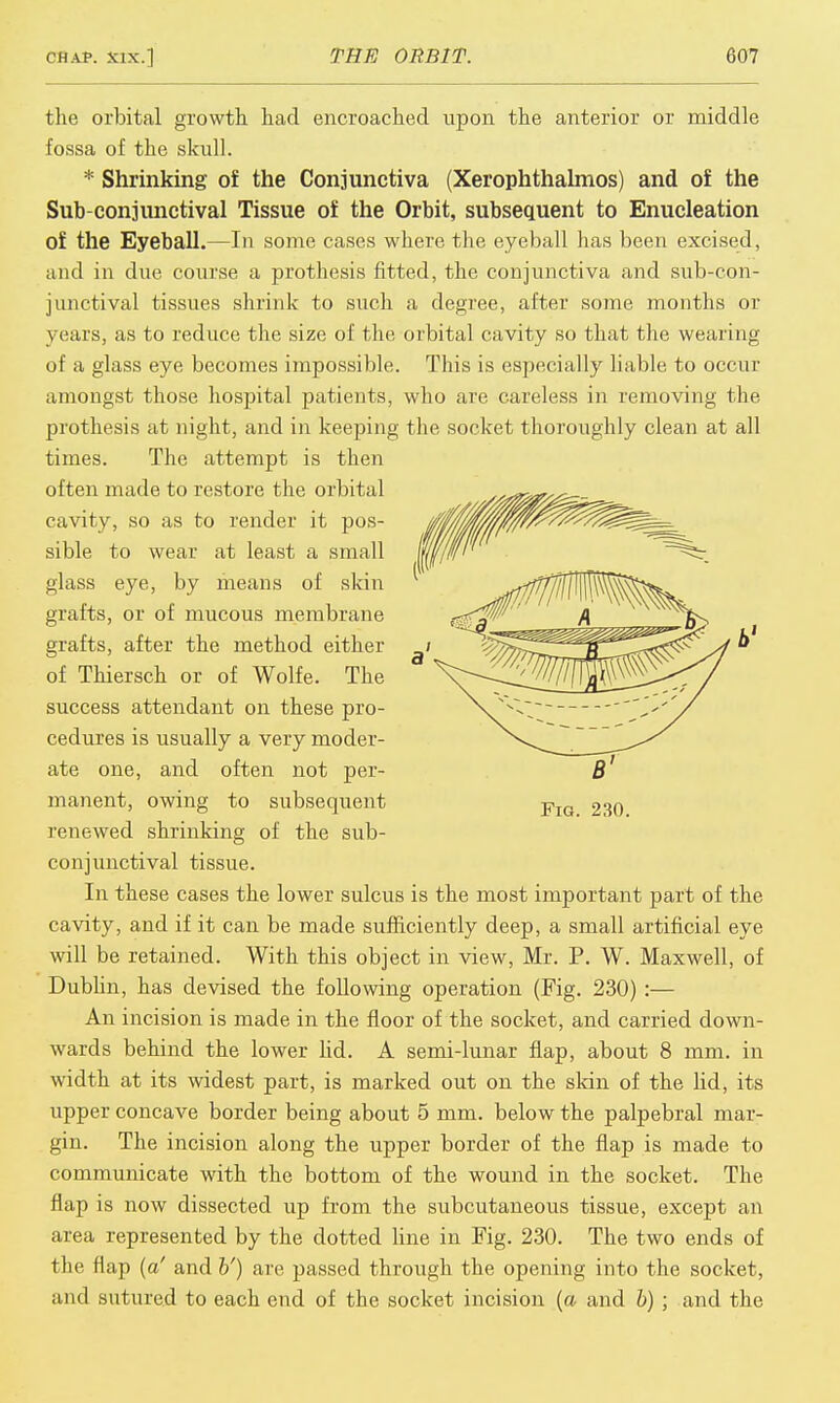 the orbital growth, had encroached upon the anterior or middle fossa of the skull. * Shrinking of the Conjunctiva (Xerophthalmos) and of the Sub conjunctival Tissue of the Orbit, subsequent to Enucleation of the Eyeball.—In some cases where the eyeball has been excised, and in due course a prothesis fitted, the conjunctiva and sub-con- junctival tissues shrink to such a degree, after some months or years, as to reduce the size of the orbital cavity so that the wearing of a glass eye becomes impossible. This is especially liable to occur amongst those hospital patients, who are careless in removing the prothesis at night, and in keeping the socket thoroughly clean at all times. The attempt is then often made to restore the orbital cavity, so as to render it pos- sible to wear at least a small glass eye, by means of skin grafts, or of mucous membrane grafts, after the method either of Thiersch or of Wolfe. The success attendant on these pro- cedures is usually a very moder- ate one, and often not per- manent, owing to subsequent renewed shrinking of the sub- conjunctival tissue. In these cases the lower sulcus is the most important part of the cavity, and if it can be made sufficiently deep, a small artificial eye will be retained. With this object in view, Mr. P. W. Maxwell, of Dublin, has devised the following operation (Fig. 230) :— An incision is made in the floor of the socket, and carried down- wards behind the lower lid. A semi-lunar flap, about 8 mm. in width at its widest part, is marked out on the skin of the lid, its upper concave border being about 5 mm. below the palpebral mar- gin. The incision along the upper border of the flap is made to communicate with the bottom of the wound in the socket. The flap is now dissected up from the subcutaneous tissue, except an area represented by the dotted line in Fig. 230. The two ends of the flap (a' and b') are passed through the opening into the socket, and sutured to each end of the socket incision (a and b) ; and the Fig. 230.