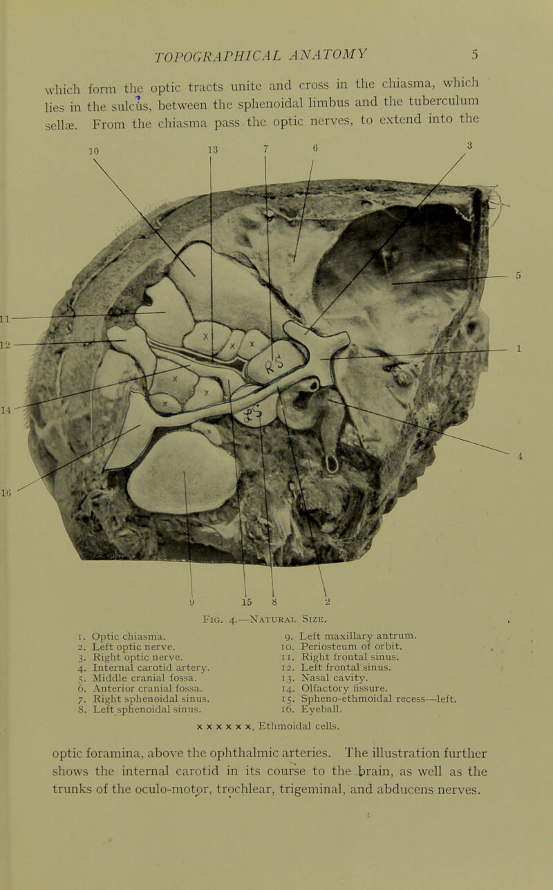 which form the optic tracts unite and cross in the chiasma, which Ues in the sulcts, between the sphenoidal Hmbus and the tubercuhim sell£e. From the chiasma pass, the optic nerves, to extend into the Fig. 4.—Natural Size. Optic chiasma. Left optic nerve. Right optic nerve. Internal carotid artery. Middle cranial fossa. Anterior cranial fossa. Right sphenoidal sinus. Left sphenoidal sinus. 9. Left maxillary antrum. 10. Periosteum of orbit. 11. Right frontal sinus. 12. Left frontal sinus. 13. Nasal cavity. 14. Olfactory fissure. 15. Spheno-ethmoidal recess—left. 16. Eyeball. X X X X X X, Ethmoidal cells. optic foramina, above the ophthalmic arteries. The illustration further shows the internal carotid in its course to the brain, as well as the trunks of the oculo-motpr, trochlear, trigeminal, and abducens nerves.