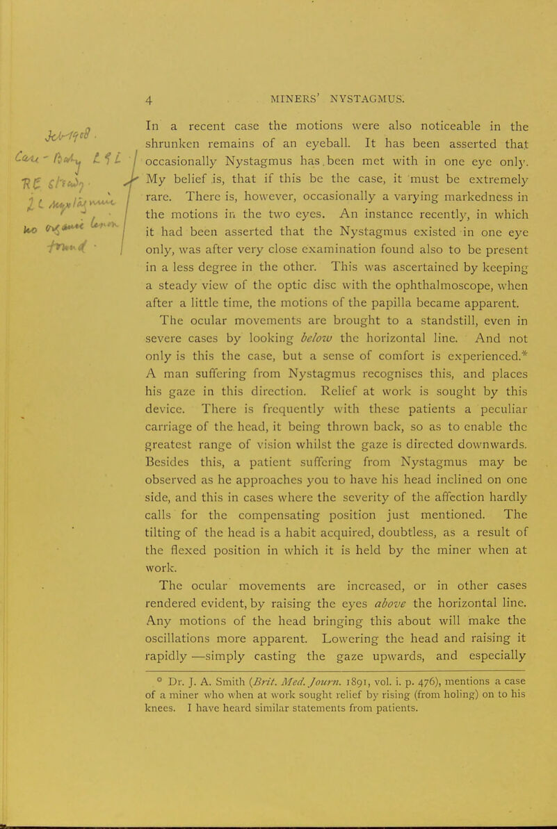 In a recent case the motions were also noticeable in the shrunken remains of an eyeball. It has been asserted that Ccuu - /^*^y / occasionally Nystagmus has . been met with in one eye only. 7?£ £ht*tj ■ belief is, that if this be the case, it must be extremely * , * / rare. There is, however, occasionally a varying markedncss in ' \ m°tlons ln tne two eyes. An instance recently, in which **o 1 / it had been asserted that the Nystagmus existed in one eye only, was after very close examination found also to be present in a less degree in the other. This was ascertained by keeping a steady view of the optic disc with the ophthalmoscope, when after a little time, the motions of the papilla became apparent. The ocular movements are brought to a standstill, even in severe cases by looking below the horizontal line. And not only is this the case, but a sense of comfort is experienced.* A man suffering from Nystagmus recognises this, and places his gaze in this direction. Relief at work is sought by this device. There is frequently with these patients a peculiar carriage of the head, it being thrown back, so as to enable the greatest range of vision whilst the gaze is directed downwards. Besides this, a patient suffering from Nystagmus may be observed as he approaches you to have his head inclined on one side, and this in cases where the severity of the affection hardly calls for the compensating position just mentioned. The tilting of the head is a habit acquired, doubtless, as a result of the flexed position in which it is held by the miner when at work. The ocular movements are increased, or in other cases rendered evident, by raising the eyes above the horizontal line. Any motions of the head bringing this about will make the oscillations more apparent. Lowering the head and raising it rapidly —simply casting the gaze upwards, and especially ° Dr. J. A. Smith {Brit. Med.Journ. 1891, vol. i. p. 476), mentions a case of a miner who when at work sought relief by rising (from holing) on to his knees. I have heard similar statements from patients.