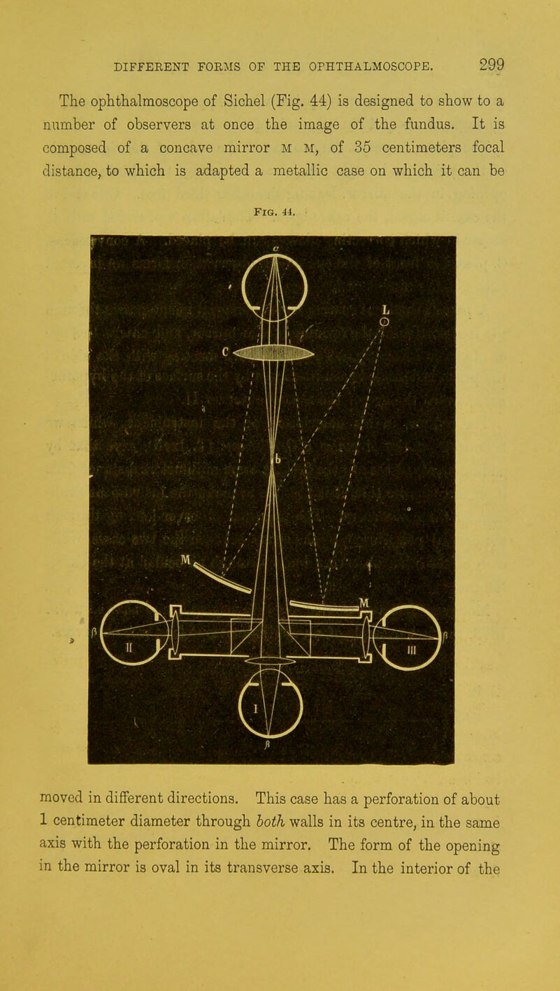 The ophthalmoscope of Sichel (Fig. 44) is designed to show to a number of observers at once the image of the fundus. It is composed of a concave mirror m M, of 35 centimeters focal distance, to which is adapted a metallic case on which it can be Fig. u. moved in different directions. This case has a perforation of about 1 centimeter diameter through both walls in its centre, in the same axis with the perforation in the mirror. The form of the opening in the mirror is oval in its transverse axis. In the interior of the