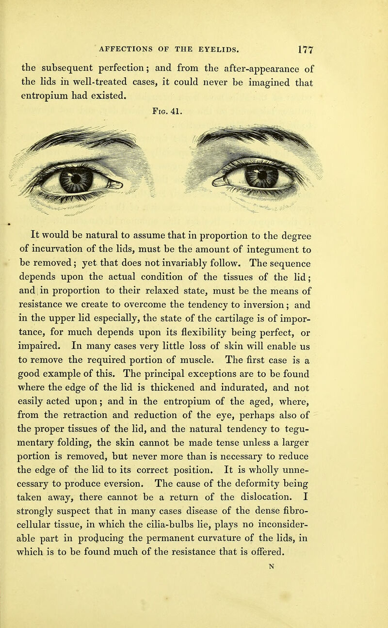 the subsequent perfection; and from the after-appearance of the lids in well-treated cases, it could never be imagined that entropium had existed. Fig. 41. It would be natural to assume that in proportion to the degree of incurvation of the lids, must be the amount of integument to be removed; yet that does not invariably follow. The sequence depends upon the actual condition of the tissues of the lid; and in proportion to their relaxed state, must be the means of resistance we create to overcome the tendency to inversion; and in the upper lid especially, the state of the cartilage is of impor- tance, for much depends upon its flexibility being perfect, or impaired. In many cases very little loss of skin will enable us to remove the required portion of muscle. The first case is a good example of this. The principal exceptions are to be found where the edge of the lid is thickened and indurated, and not easily acted upon; and in the entropium of the aged, where, from the retraction and reduction of the eye, perhaps also of the proper tissues of the lid, and the natural tendency to tegu- mentary folding, the skin cannot be made tense unless a larger portion is removed, but never more than is necessary to reduce the edge of the lid to its correct position. It is wholly unne- cessary to produce eversion. The cause of the deformity being taken away, there cannot be a return of the dislocation. I strongly suspect that in many cases disease of the dense fibro- cellular tissue, in which the cilia-bulbs lie, plays no inconsider- able part in producing the permanent curvature of the lids, in which is to be found much of the resistance that is offered. N