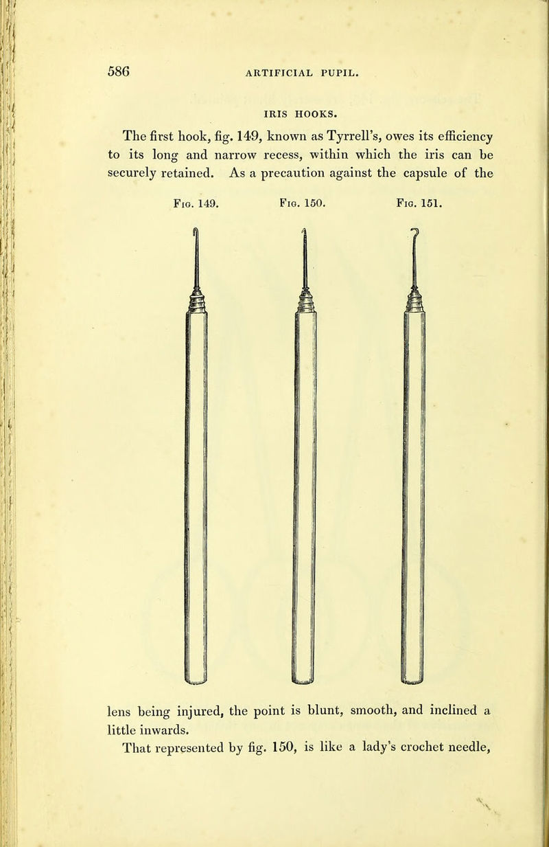 IRIS HOOKS. The first hook, fig. 149, known as Tyrrell's, owes its efiiciency to its long and narrow recess, within which the iris can be securely retained. As a precaution against the capsule of the Fig. 149. Fig. 150. Fig. 151. u lens being injured, the point is blunt, smooth, and inclined a little inwards. That represented by fig. 150, is like a lady's crochet needle,