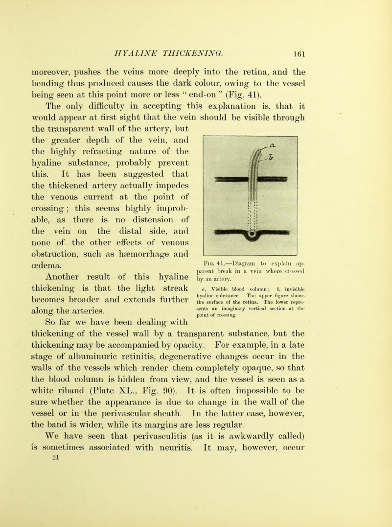 moreover, pushes the veins more deeply into the retina, and the bending thus produced causes the dark colour, owing to the vessel being seen at this point more or less  end-on  (Fig. 41), The only difficulty in accepting this explanation is, that it would appear at first sight that the vein should be visible through the transparent wall of the artery, but the greater depth of the vein, and the highly refracting nature of the hyaline substance, probably prevent this. It has been suggested that the thickened artery actually impedes the venous current at the point of crossing; this seems highly improb- able, as there is no distension of the vein on the distal side, and none of the other effects of venous obstruction, such as hsemorrhage and oedema. Another result of this hyaline thickening is that the light streak becomes broader and extends further along the arteries. So far we have been dealing with thickening of the vessel wall by a transparent substance, but the thickening may be accompanied by opacity. For example, in a late stage of albuminuric retinitis, degenerative changes occur in the walls of the vessels which render them completely opaque, so that the blood column is hidden from view, and the vessel is seen as a white riband (Plate XL., Fig. 90). It is often imposvsible to be sure whether the appearance is due to change in the wall of the vessel or in the perivascular sheath. In the latter case, however, the band is wider, while its margins are less regular. We have seen that perivasculitis (as it is awkwardly called) is sometimes associated with neuritis. It may, however, occur 21 Fig. 41.—Diagram to explain ap- parent break in a vein where crossed by an artery. a, Visible blood column; b, invisible hyaline substance. The upper figure shows the surface of the retina. The lower repre- sents an imaginary vertical section at the point of crossing.