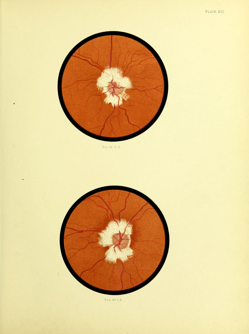 Fig.37. L.^