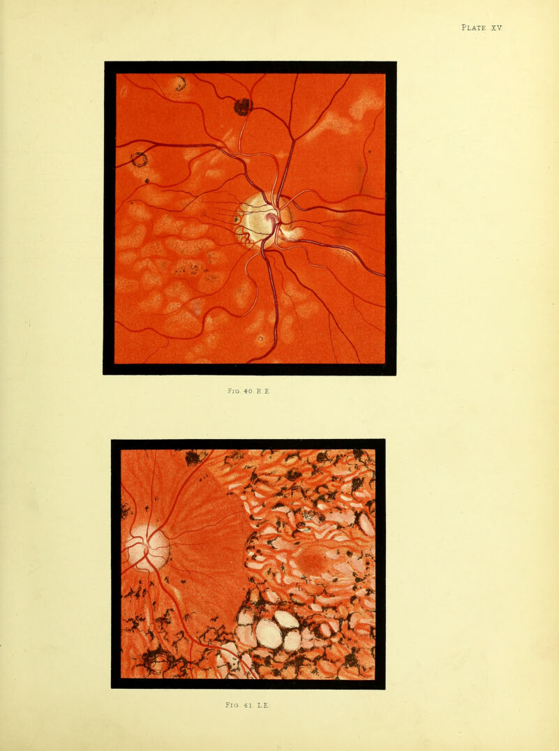 Fig, 40, R E Fig. 41. L.F