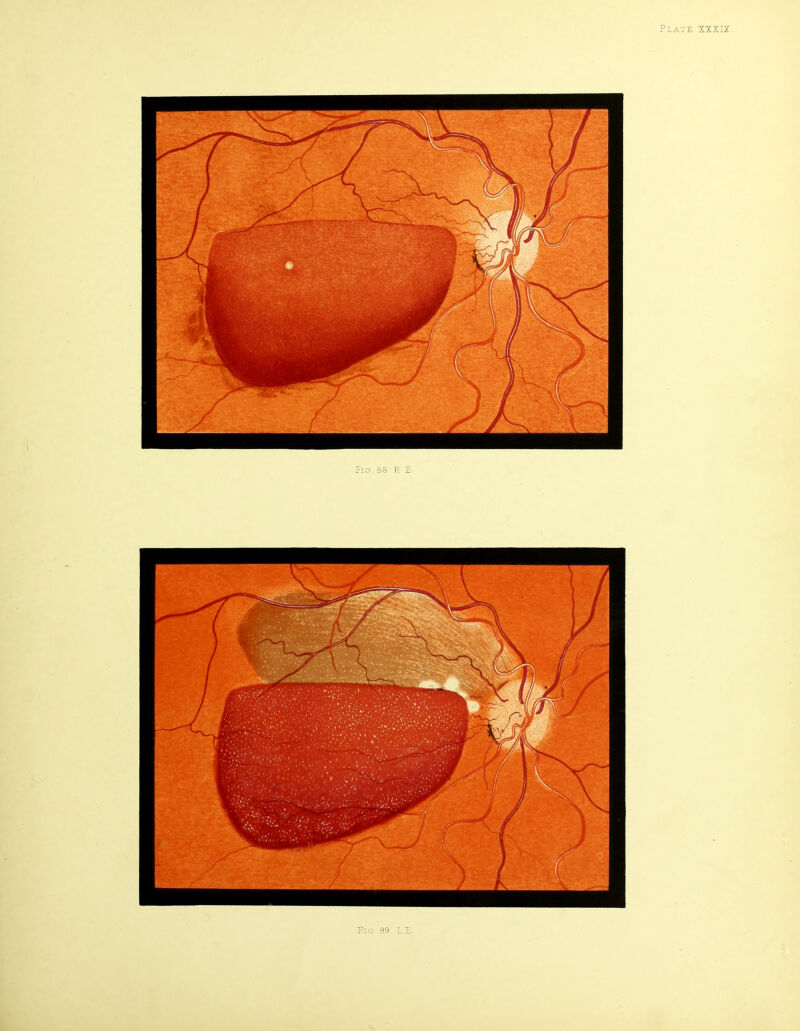 Fig. 89 LE.