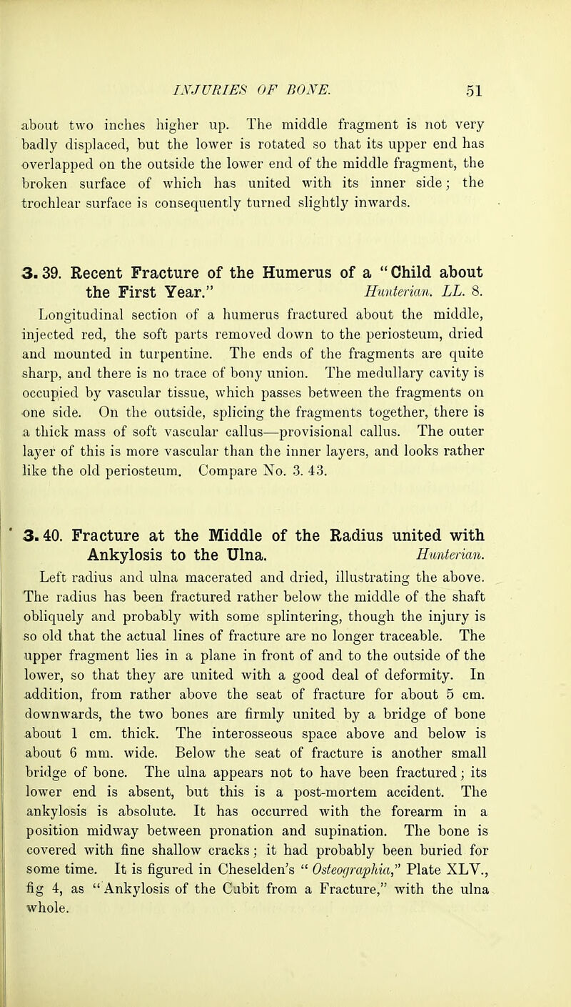 about two inches higher up. The middle fragment is not very badly displaced, but the lower is rotated so that its upper end has overlapped on the outside the lower end of the middle fragment, the broken surface of which has united with its inner side; the trochlear surface is consequently turned slightly inwards. 3.39. Recent Fracture of the Humerus of a  Child about the First Year. Hunterian. LL. 8. Longitudinal section of a humerus fractured about the middle, injected red, the soft parts removed down to the periosteum, dried and mounted in turpentine. The ends of the fragments are cj[uite sharp, and there is no trace of bony union. The medullary cavity is occupied by vascular tissue, which passes between the fragments on •one side. On the outside, splicing the fragments together, there is a thick mass of soft vase alar callus—provisional callus. The outer layer of this is more vascular than the inner layers, and looks rather like the old periosteum. Compare Xo. 3. 43. 3.40. Fracture at the Middle of the Radius united with Ankylosis to the Ulna. Hunterian. Left radius and ulna macerated and dried, illustrating the above. The radius has been fractured rather below the middle of the shaft obliquely and probably with some splintering, though the injury is so old that the actual lines of fracture are no longer traceable. The upper fragment lies in a plane in front of and to the outside of the lower, so that they are imited with a good deal of deformity. In addition, from rather above the seat of fracture for about 5 cm. downwards, the two bones are firmly united by a bridge of bone about 1 cm. thick. The interosseous space above and below is about 6 mm. wide. Below the seat of fracture is another small bridge of bone. The ulna appears not to have been fractured; its lower end is absent, but this is a post-mortem accident. The ankylosis is absolute. It has occurred with the forearm in a position midway between pronation and supination. The bone is covered with fine shallow cracks; it had probably been buried for some time. It is figured in Cheselden's  Osteographia, Plate XLV., fig 4, as Ankylosis of the Cabit from a Fracture, with the ulna whole.