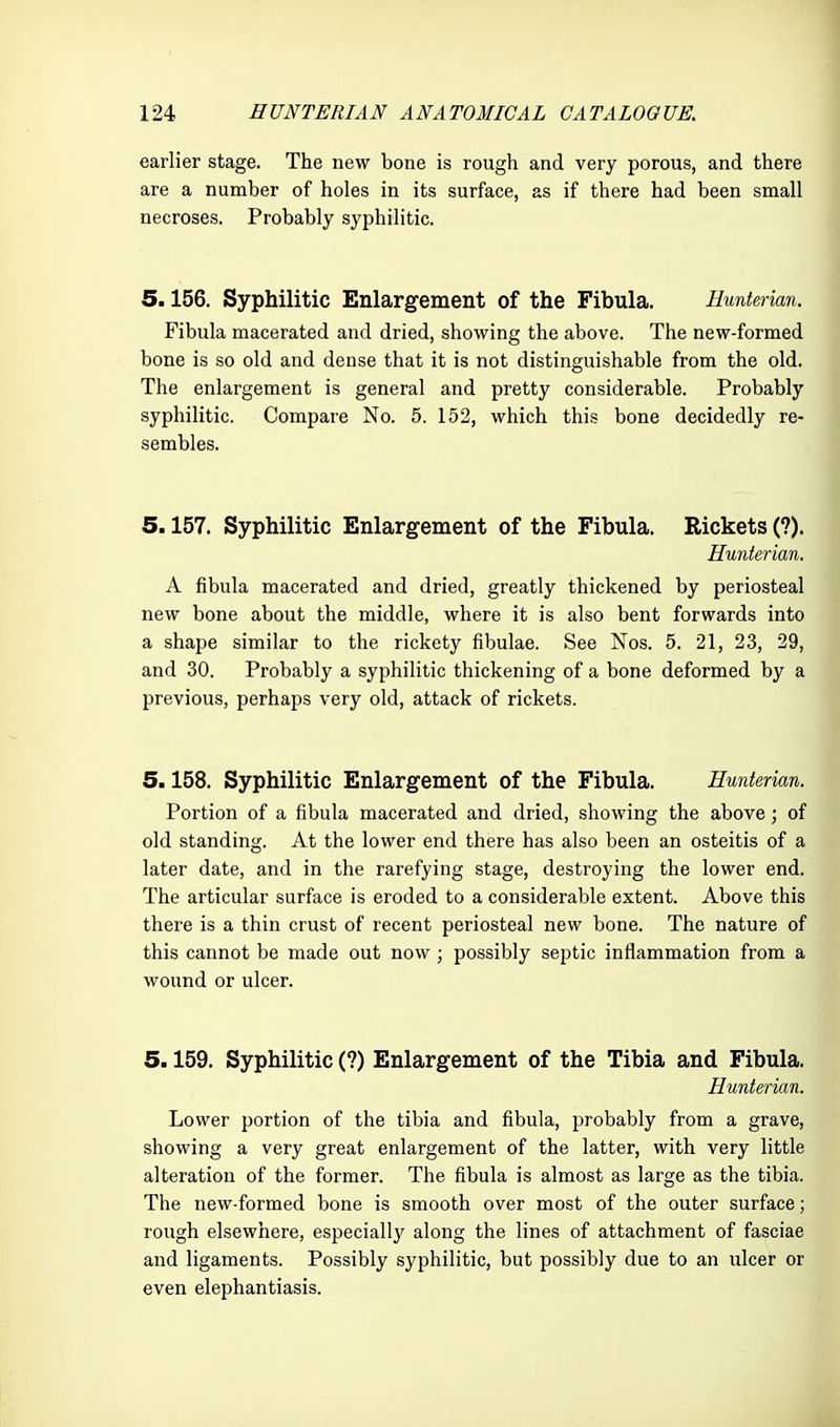 earlier stage. The new bone is rough and very porous, and there are a number of holes in its surface, as if there had been small necroses. Probably syphilitic. 5.156. Syphilitic Enlargement of the Fibula. Hunterian. Fibula macerated and dried, showing the above. The new-formed bone is so old and dense that it is not distinguishable from the old. The enlargement is general and pretty considerable. Probably syphilitic. Compare No. 5. 152, which this bone decidedly re- sembles. 5.157. Syphilitic Enlargement of the Fibula. Rickets (?). Hunterian. A fibula macerated and dried, greatly thickened by periosteal new bone about the middle, where it is also bent forwards into a shape similar to the rickety fibulae. See Nos. 5. 21, 23, 29, and 30. Probably a syphilitic thickening of a bone deformed by a previous, perhaps very old, attack of rickets. 5.158. Syphilitic Enlargement of the Fibula. Hunterian. Portion of a fibula macerated and dried, showing the above; of old standing. At the lower end there has also been an osteitis of a later date, and in the rarefying stage, destroying the lower end. The articular surface is eroded to a considerable extent. Above this there is a thin crust of recent periosteal new bone. The nature of this cannot be made out now ; possibly septic inflammation from a wound or ulcer. 5.159. Syphilitic (?) Enlargement of the Tibia and Fibula. Hunterian. Lower portion of the tibia and fibula, probably from a grave, showing a very great enlargement of the latter, with very little alteration of the former. The fibula is almost as large as the tibia. The new-formed bone is smooth over most of the outer surface; rough elsewhere, especially along the lines of attachment of fasciae and ligaments. Possibly syphilitic, but possibly due to an ulcer or even elephantiasis.