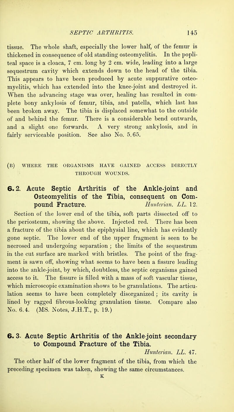 tissue. The whole shaft, especially the lower half, of the femur is thickened in consequence of old standing osteomyelitis. In the popli- teal space is a cloaca, 7 cm. long by 2 cm. wide, leading into a large sequestrum cavity which extends down to the head of the tibia. This appears to have been produced by acute suppurative osteo- myelitis, which has extended into the knee-joint and destroyed it. When the advancing stage was over, healing has resulted in com- plete bony ankylosis of femur, tibia, and patella, which last has been broken away. The tibia is displaced somewhat to the outside of and behind the femur. There is a considerable bend outwards, and a slight one forwards. A very strong ankylosis, and in fairly serviceable position. See also No. 5.65. (b) where the organisms have gained access directly through wounds. 6.2. Acute Septic Arthritis of the Ankle-joint and Osteomyelitis of the Tibia, consequent on Com- pound Fracture. Himterian. LL. 12. Section of the lower end of the tibia, soft parts dissected off to the periosteum, showing the above. Injected red. There has been a fracture of the tibia about the epiphysial line, which has evidently gone septic. The lower end of the upper fragment is seen to be necrosed and undergoing separation ; the limits of the sequestrum in the cut surface are marked with bristles. The point of the frag- ment is sawn off, showing what seems to have been a fissure leading into the ankle-joint, by which, doubtless, the septic organisms gained access to it. The fissure is filled with a mass of soft vascular tissue, which microscopic examination shows to be granulations. The articu- lation seems to have been completely disorganized; its cavity is lined by ragged fibrous-looking granulation tissue. Compare also No. 6.4. (MS. Notes, J.H.T., p. 19.) 6. 3. Acute Septic Arthritis of the Ankle-joint secondary to Compound Fracture of the Tibia. Hunterian. LL. 47. The other half of the lower fragment of the tibia, from which the preceding specimen was taken, showing the same circumstances. K