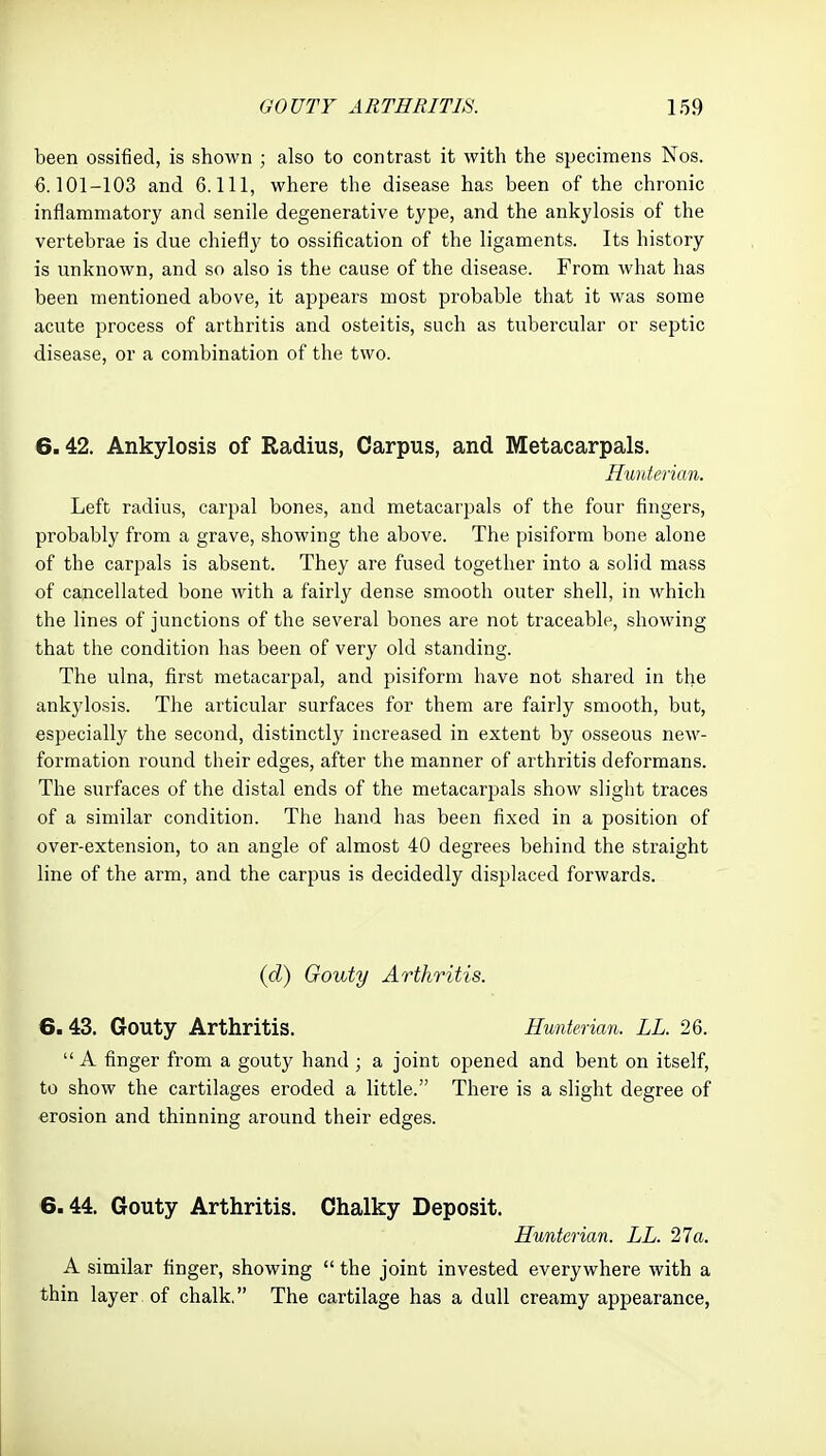 been ossified, is shown ; also to contrast it with the specimens Nos. 6.101-103 and 6.111, where the disease has been of the chronic inflammatory and senile degenerative type, and the ankylosis of the vertebrae is due chiefly to ossification of the ligaments. Its history is unknown, and so also is the cause of the disease. From what has been mentioned above, it appears most probable that it was some acute process of arthritis and osteitis, such as tubercular or septic disease, or a combination of the two. 6.42. Ankylosis of Radius, Carpus, and Metacarpals. H'unterian. Left radius, carpal bones, and metacarpals of the four fingers, probably from a grave, showing the above. The pisiform bone alone of the carpals is absent. They are fused together into a solid mass of cancellated bone with a fairly dense smooth outer shell, in which the lines of junctions of the several bones are not traceable, showing that the condition has been of very old standing. The ulna, first metacarpal, and pisiform have not shared in the ankylosis. The articular surfaces for them are fairly smooth, but, especially the second, distinctly increased in extent by osseous new- formation round their edges, after the manner of arthritis deformans. The surfaces of the distal ends of the metacarpals show slight traces of a similar condition. The hand has been fixed in a position of over-extension, to an angle of almost 40 degrees behind the straight line of the arm, and the carpus is decidedly displaced forwards. {d) Gouty Arthritis. 6.43. Gouty Arthritis. Hunterian. LL. 26.  A finger from a gouty hand ; a joint opened and bent on itself, to show the cartilages eroded a little. There is a slight degree of erosion and thinning around their edges. 6.44. Gouty Arthritis. Chalky Deposit. Hunterian. LL. 27a. A similar finger, showing  the joint invested everywhere with a thin layer of chalk. The cartilage has a dull creamy appearance,