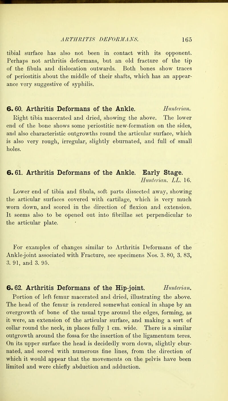 tibial surface has also not been in contact with its opponent. Perhaps not arthritis deformans, but an old fracture of the tip of the fibula and dislocation outwards. Both bones show traces of periostitis about the middle of their shafts, which has an appear- ance very suggestive of syphilis. 6.60. Arthritis Deformans of the Ankle. Hunterian. Kight tibia macerated and dried, showing the above. The lower end of the bone shows some periostitic new-formation on the sides, and also characteristic outgrowths round the articular surface, which is also very rough, irregular, slightly eburnated, and full of small holes. 6.61. Arthritis Deformans of the Ankle. Early Stage. Hunterian. LL. 16. Lower end of tibia and fibula, soft parts dissected away, showing the articular surfaces covered with cartilage, which is very much worn down, and scored in the direction of flexion and extension. It seems also to be opened out into fibrillae set perpendicular to the articular plate. For examples of changes similar to Arthritis Deformans of the Ankle-joint associated with Fracture, see specimens Nos. 3. 80, 3. 83, 3. 91, and 3. 95. 6.62. Arthritis Deformans of the Hip-joint. Hunterian. Portion of left femur macerated and dried, illustrating the above. The head of the femur is rendered somewhat conical in shape by an overgrowth of bone of the usual type around the edges, forming, as it were, an extension of the articular surface, and making a sort of collar round the neck, in places fully 1 cm. wide. There is a similar outgrowth around the fossa for the insertion of the ligamentum teres. On its upper surface the head is decidedly worn down, slightly ebur- nated, and scored with numerous fine lines, from the direction of which it would appear that the movements on the pelvis have been limited and were chiefly abduction and adduction.