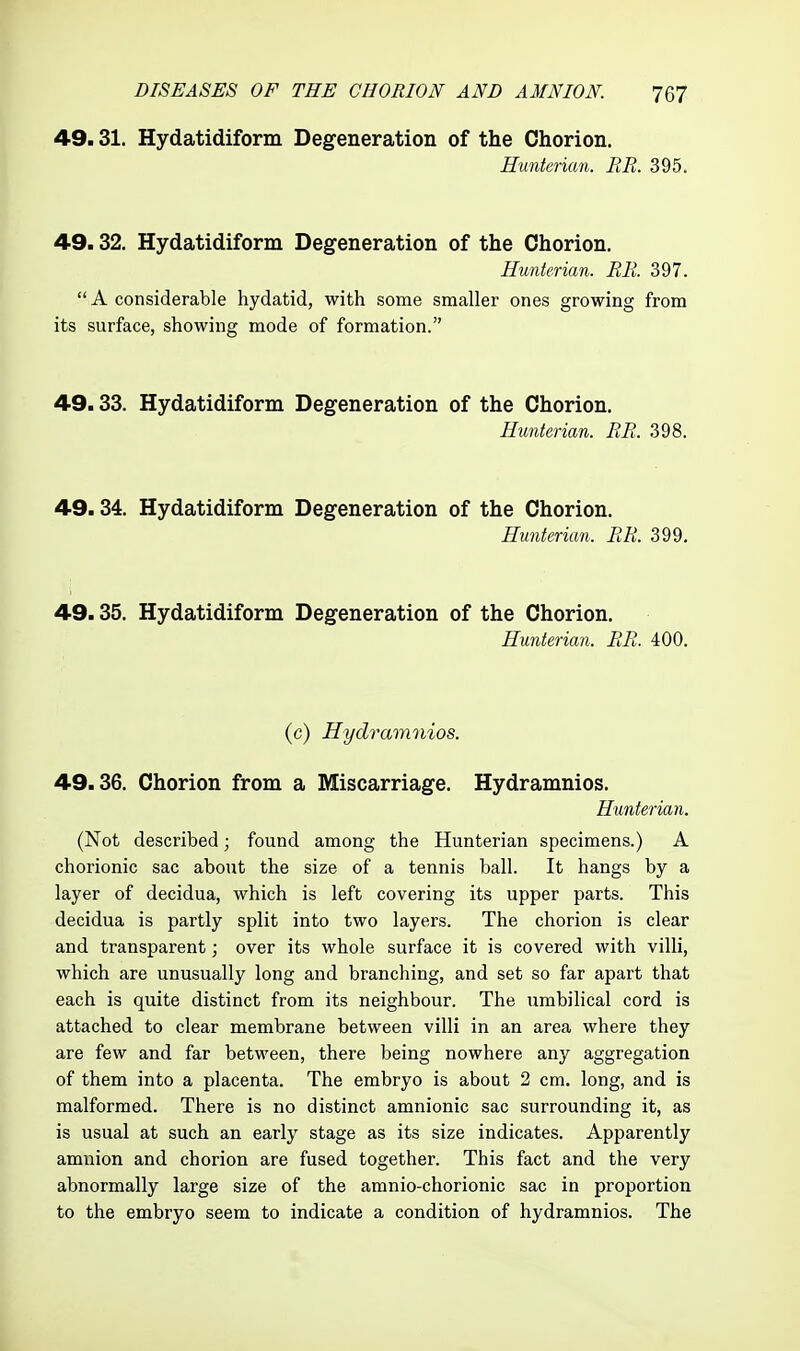 49.31. Hydatidiform Degeneration of the Chorion. Hiinterian. RR. 395. 49.32. Hydatidiform Degeneration of the Chorion. Hunterian. RR. 397.  A considerable hydatid, with some smaller ones growing from its surface, showing mode of formation. 49.33. Hydatidiform Degeneration of the Chorion. Hunterian. RR. 398. 49.34. Hydatidiform Degeneration of the Chorion. Hunterian. RR. 399. 49.35. Hydatidiform Degeneration of the Chorion. Hunterian. RR. 400. (c) Hydramnios. 49.36. Chorion from a Miscarriage. Hydramnios. Hunterian. (Not described; found among the Hunterian specimens.) A chorionic sac about the size of a tennis ball. It hangs by a layer of decidua, which is left covering its upper parts. This decidua is partly split into two layers. The chorion is clear and transparent; over its whole surface it is covered with villi, which are unusually long and branching, and set so far apart that each is quite distinct from its neighbour. The umbilical cord is attached to clear membrane between villi in an area where they are few and far between, there being nowhere any aggregation of them into a placenta. The embryo is about 2 cm. long, and is malformed. There is no distinct amnionic sac surrounding it, as is usual at such an early stage as its size indicates. Apparently amnion and chorion are fused together. This fact and the very abnormally large size of the amnio-chorionic sac in proportion to the embryo seem to indicate a condition of hydramnios. The