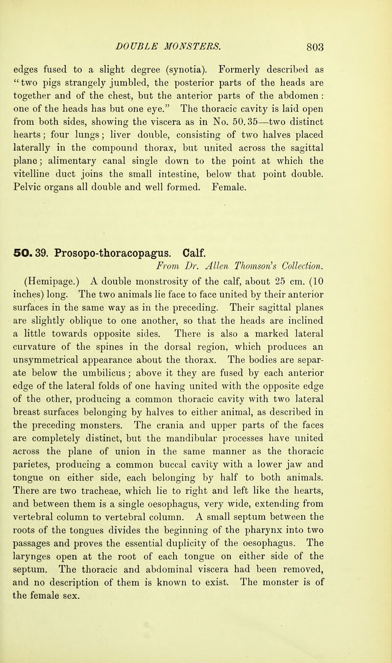 edges fused to a slight degree (synotia). Formerly described as  two pigs strangely jumbled, the posterior parts of the heads are together and of the chest, but the anterior parts of the abdomen : one of the heads has but one eye. The thoracic cavity is laid open from both sides, showing the viscera as in No. 50.35—two distinct hearts; four lungs; liver double, consisting of two halves placed laterally in the compound thorax, but united across the sagittal plane; alimentary canal single down to the point at which the vitelline duct joins the small intestine, below that point double. Pelvic organs all double and well formed. Female. 50.39. Prosopo-thoracopagus. Calf. From Dr. Allen Thomson's Collection. (Hemipage.) A double monstrosity of the calf, about 25 cm. (10 inches) long. The two animals lie face to face united by their anterior surfaces in the same way as in the preceding. Their sagittal planes are slightly oblique to one another, so that the heads are inclined a little towards opposite sides. There is also a marked lateral curvature of the spines in the dorsal region, which produces an unsymmetrical appearance about the thorax. The bodies are separ- ate below the umbilicus; above it they are fused by each anterior edge of the lateral folds of one having united with the opposite edge of the other, producing a common thoracic cavity with two lateral breast surfaces belonging by halves to either animal, as described in the preceding monsters. The crania and upper parts of the faces are completely distinct, but the mandibular processes have united across the plane of union in the same manner as the thoracic parietes, producing a common buccal cavity with a lower jaw and tongue on either side, each belonging by half to both animals. There are two tracheae, which lie to right and left like the hearts, and between them is a single oesophagus, very wide, extending from vertebral column to vertebral column. A small septum between the roots of the tongues divides the beginning of the pharynx into two passages and proves the essential duplicity of the oesophagus. The larynges open at the root of each tongue on either side of the septum. The thoracic and abdominal viscera had been removed, and no description of them is known to exist. The monster is of the female sex.