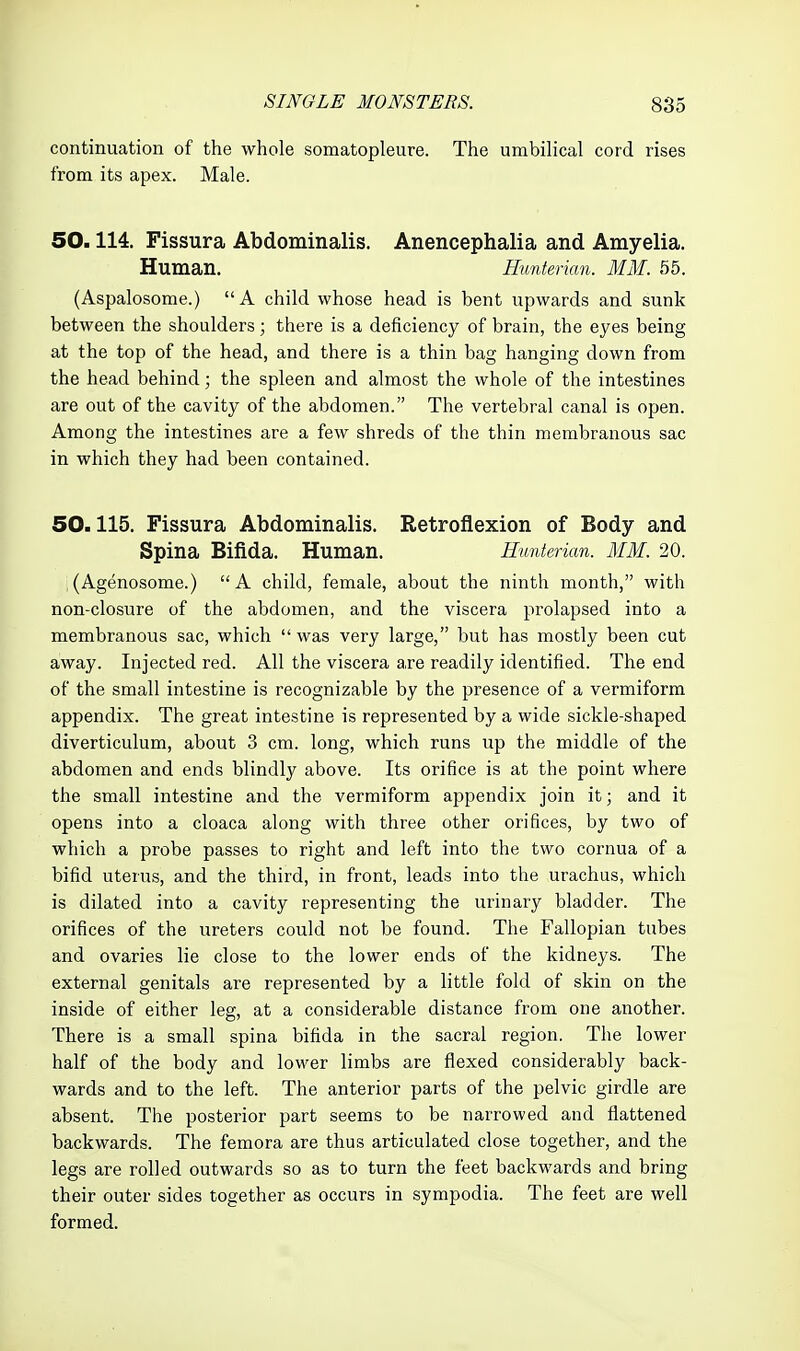 continuation of the whole somatopleure. The umbilical cord rises from its apex. Male. 50.114. Fissura Abdominalis. Anencephalia and Amyelia. Human. Hunterian. MM. 55. (Aspalosome.) A child whose head is bent upwards and sunk between the shoulders; there is a deficiency of brain, the eyes being at the top of the head, and there is a thin bag hanging down from the head behind; the spleen and almost the whole of the intestines are out of the cavity of the abdomen. The vertebral canal is open. Among the intestines are a few shreds of the thin membranous sac in which they had been contained. 50.115. Fissura Abdominalis. Retroflexion of Body and Spina Bifida. Human. Hunterian. MM. 20. (Agenosome.) A child, female, about the ninth month, with non-closure of the abdomen, and the viscera prolapsed into a membranous sac, which  was very large, but has mostly been cut away. Injected red. All the viscera a,re readily identified. The end of the small intestine is recognizable by the presence of a vermiform appendix. The great intestine is represented by a wide sickle-shaped diverticulum, about 3 cm. long, which runs up the middle of the abdomen and ends blindly above. Its orifice is at the point where the small intestine and the vermiform appendix join it; and it opens into a cloaca along with three other orifices, by two of which a probe passes to right and left into the two cornua of a bifid uterus, and the third, in front, leads into the urachus, which is dilated into a cavity representing the urinary bladder. The orifices of the ureters could not be found. The Fallopian tubes and ovaries lie close to the lower ends of the kidneys. The external genitals are represented by a little fold of skin on the inside of either leg, at a considerable distance from one another. There is a small spina bifida in the sacral region. The lower half of the body and lower limbs are flexed considerably back- wards and to the left. The anterior parts of the pelvic girdle are absent. The posterior part seems to be narrowed and flattened backwards. The femora are thus articulated close together, and the legs are rolled outwards so as to turn the feet backwards and bring their outer sides together as occurs in sympodia. The feet are well formed.