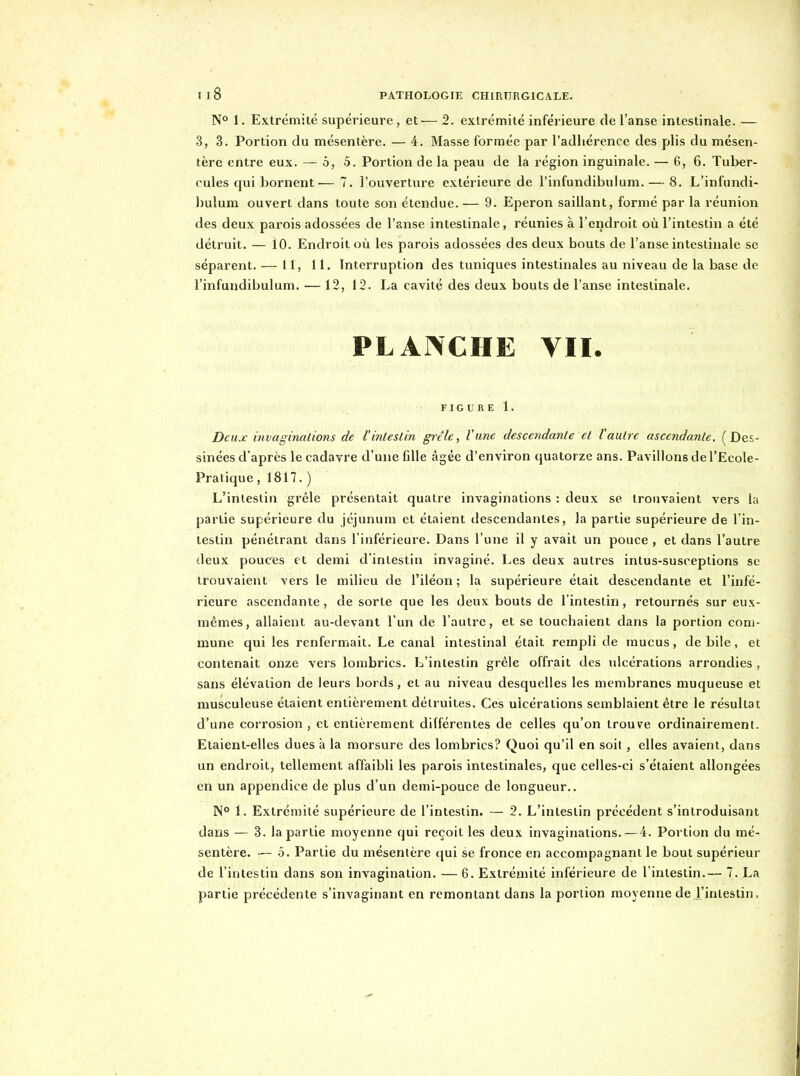 N° 1. Extrémité supérieure , et— 2. extrémité inférieure de l'anse intestinale. — 3, 3. Portion du mésentère. — 4. Masse formée par l'adhérence des plis du mésen- tère entre eux. — 5,5. Portion de la peau de la région inguinale. — 6, 6. Tuber- cules qui bornent— 7. l'ouverture extérieure de l'infundibulum. — 8. L'infundi- l)ulum ouvert dans toute son étendue. — 9. Eperon saillant, formé par la réunion des deux parois adossées de l'anse intestinale, réunies à l'endroit où l'intestin a été détruit. — 10. Endroit où les parois adossées des deux bouts de l'anse intestinale se séparent. — 11, 11. Interruption des tuniques intestinales au niveau de la base de l'infundibulum. — 12, 12. La cavité des deux bouts de l'anse intestinale. PLANCHE VII. FI G U R E 1. Deux invaginations de Pintestin grêle, l'une descendante et Vautre ascendante. (Des- sinées d'après le cadavre d'une fille âgée d'environ quatorze ans. Pavillons de l'Ecole- Praiique, 1817. ) L'inleslin grêle présentait quatre invaginations : deux se trouvaient vers la partie supérieure du jéjunum et étaient descendantes, la partie supérieure de l'in- testin pénétrant dans l'inférieure. Dans l'une il y avait un pouce , et dans l'autre deux pouces et demi d'intestin invaginé. Les deux autres intus-susoeplions se trouvaient vers le milieu de l'iléon ; la supérieure était descendante et l'infé- rieure ascendante, de sorte que les deux bouts de l'intestin, retournés sur eux- mêmes, allaient au-devant l'un de l'autre, et se touchaient dans la portion com- mune qui les renfermait. Le canal intestinal était rempli de mucus, de bile, et contenait onze vers lombrics. L'intestin grêle offrait des ulcérations arrondies , sans élévation de leurs bords, et au niveau desquelles les membranes muqueuse et musculeuse étaient entièrement détruites. Ces ulcérations semblaient être le résultat d'une corrosion , et entièrement différentes de celles qu'on trouve ordinairement. Etaient-elles dues à la morsure des lombrics? Quoi qu'il en soit, elles avaient, dans un endroit, tellement affaibli les parois intestinales, que celles-ci s'étaient allongées en un appendice de plus d'un demi-pouce de longueur.. N° 1. Extrémité supérieure de l'intestin. — 2. L'intestin précédent s'introduisant dans — 3. la partie moyenne qui reçoit les deux invaginations. — 4. Portion du mé- sentère. — 5. Partie du mésentère ({ui se fronce en accompagnant le bout supérieur de l'intestin dans son invagination. — 6. Extrémité inférieure de l'intestin.— 7. La partie précédente s'invagiriant en remontant dans la portion moyenne de l'intestin.