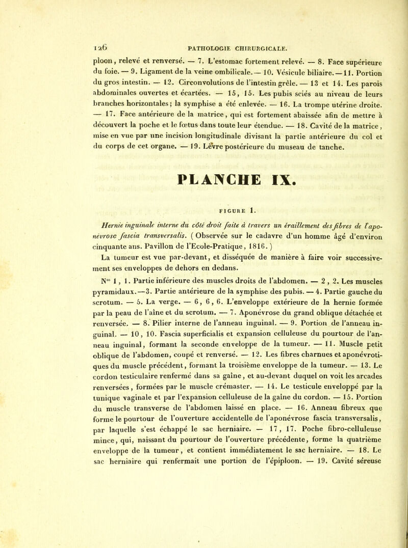 ploon, relevé et renversé. — 7. L'estomac fortement relevé. — 8. Face supérieure du foie. — 9. Ligament de la veine ombilicale.-— 10. Vésicule biliaire. —II. Portion du gros intestin. — 12. Circonvolutions de l'intestin grêle. — 13 et 14. Les parois abdominales ouvertes et écartées. — 15, 15. Les pubis sciés au niveau de leurs branches horizontales; la symphise a été enlevée. — 16. La trompe utérine droite. — 17. Face antérieure de la matrice, qui est fortement abaissée afin de mettre à découvert la poche et le fœtus dans toute leur étendue. — 18. Cavité de la matrice, mise en vue par une incision longitudinale divisant la partie antérieure du col et du corps de cet organe. — 19. Lèvre postérieure du museau de tanche. PLANCHE IX. FIGURE 1. Hernie inguinale interne du côté droit faite à travers un éraillement desfibres de îapo- névrose Jascia transversalis. ( Observée sur le cadavre d'un homme âgé d'environ cinquante ans. Pavillon de l'Ecole-Pratique, 1816. ) La tumeur est vue par-devant, et disséquée de manière à faire voir successive- ment ses enveloppes de dehors en dedans. N°' 1, 1. Partie inférieure des muscles droits de l'abdomen. — 2,2. Les muscles pyramidaux.—3. Partie antérieure de la symphise des pubis. — 4. Partie gauche du scrotum. — 5. La verge. — 6,6,6. L'enveloppe extérieure de la hernie formée par la peau de l'aine et du scrotum. — 7. Aponévrose du grand oblique détachée et renversée, — 8. Pilier interne de l'anneau inguinal. — 9. Portion de l'anneau in- guinal. — 10, 10. Fascia superficialis et expansion celluleuse du pourtour de l'an- neau inguinal, formant la seconde enveloppe de la tumeur. —11. Muscle petit oblique de l'abdomen, coupé et renversé. — 12. Les fibres charnues et aponévroti- ques du muscle précédent, formant la troisième enveloppe de la tumeur. — 13. Le cordon testiculaire renfermé dans sa gaine, et au-devant duquel on voit les arcades renversées, formées par le muscle crémaster. — 14. Le testicule enveloppé par la tunique vaginale et par l'expansion celluleuse de la gaine du cordon. — 15. Portion du muscle transverse de l'abdomen laissé en place. — 16. Anneau fibreux que forme le pourtour de l'ouverture accidentelle de l'aponévrose fascia transversalis, par laquelle s'est échappé le sac herniaire. — 17, 17. Poche fibro-celluleuse mince, qui, naissant du pourtour de l'ouverture précédente, forme la quatrième enveloppe de la tumeur, et contient immédiatement le sac herniaire. — 18. Le sac herniaire qui renfermait une portion de l'épiploon. — 19. Cavité séreuse