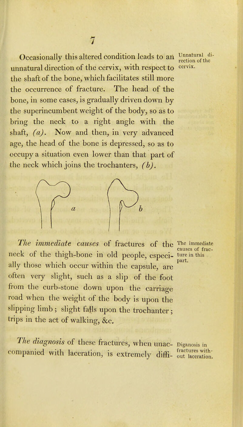 Occasionally this altered condition leads to an ^jo^^ of\he' unnatural direction of the cervix, with respect to cervix, the shaft of the bone, which facilitates still more the occurrence of fracture. The head of the bone, in some cases, is gradually driven down by the superincumbent weight of the body, so as to bring the neck to a right angle with the shaft, (a). Now and then, in very advanced age, the head of the bone is depressed, so as to occupy a situation even lower than that part of the neck which joins the trochanters, (b). The immediate causes of fractures of the immediate ... . causes of frac- neck ot the thigh-bone m old people, especi- t^^e in this ally those which occur within the capsule, are often very slight, such as a slip of the foot from the curb-stone down upon the carriage road when the weight of the body is upon the slipping limb ; slight falls upon the trochanter; trips in the act of walking, &c. The diagnosis of these fractures, when unac- Diganosis in companied with laceration, is extremely diffi- ou'Saton.