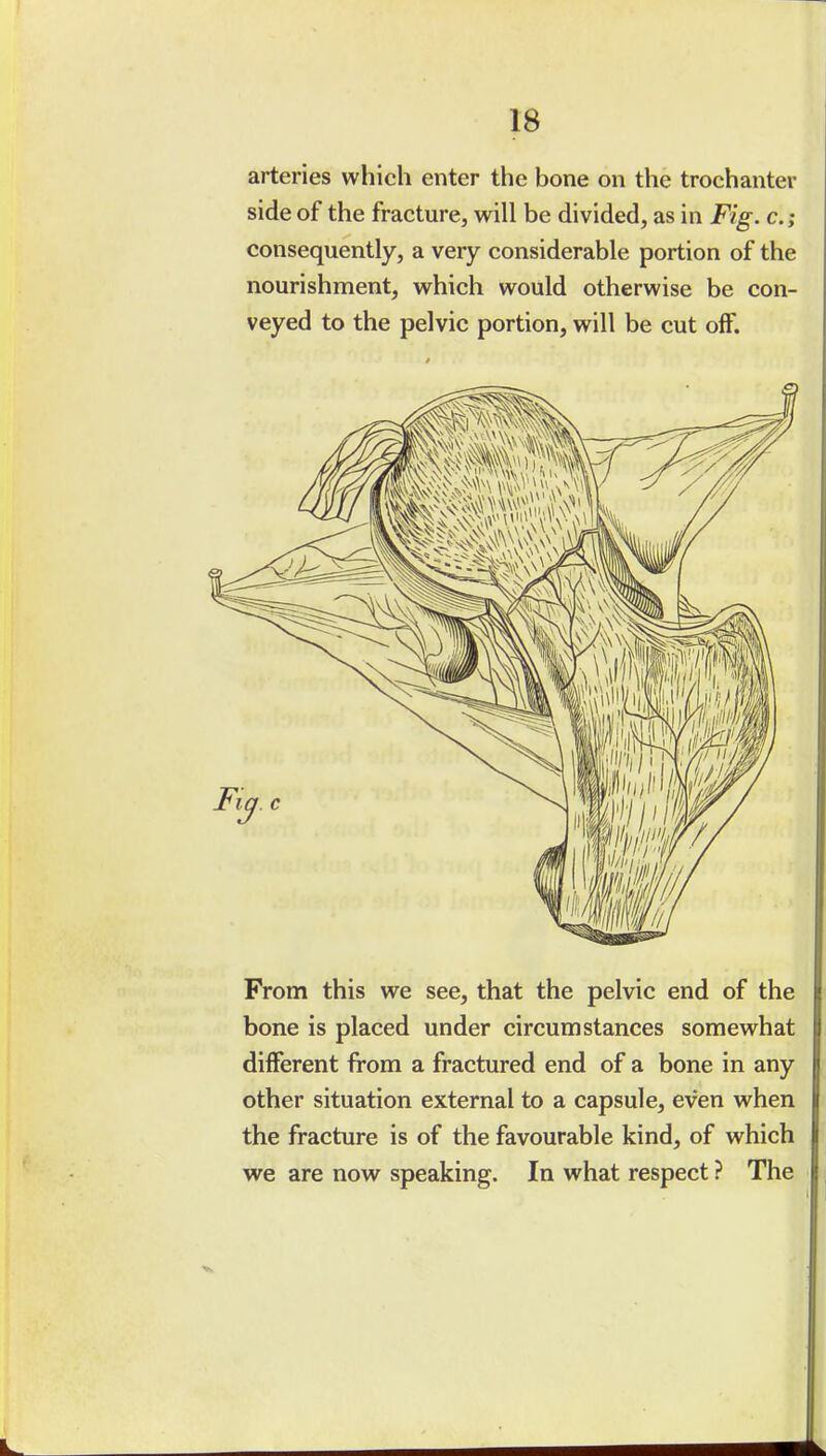 arteries which enter the bone on the trochanter side of the fracture, will be divided, as in Fig. c; consequently, a very considerable portion of the nourishment, which would otherwise be con- veyed to the pelvic portion, will be cut off. From this we see, that the pelvic end of the bone is placed under circumstances somewhat different from a fractured end of a bone in any other situation external to a capsule, even when the fracture is of the favourable kind, of which we are now speaking. In what respect ? The