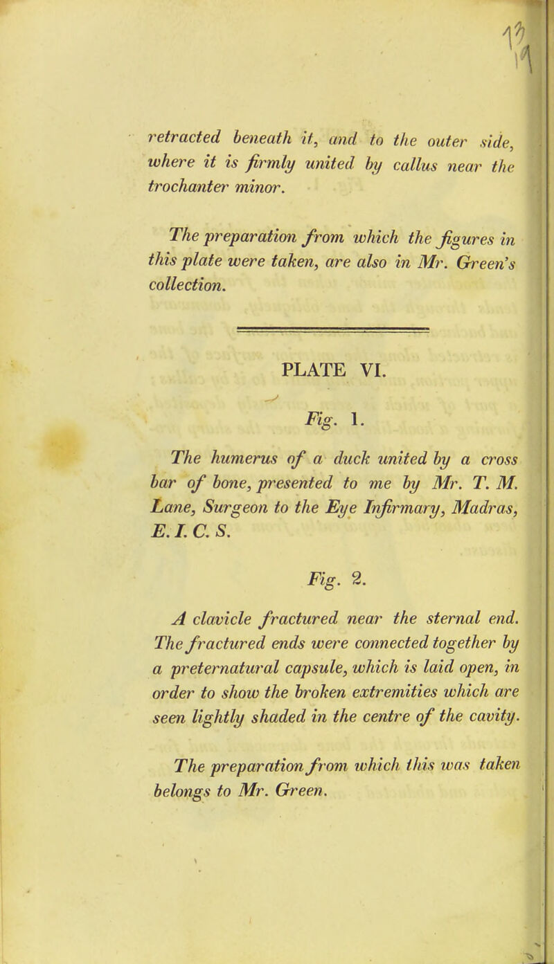 retracted beneath it, and to the outer aide, where it is firmly united hy callus near the trochanter minor. The preparation from which the figures in this plate were taken, are also in Mr. Green's collection. PLATE VI. Fig. I. The humerus of a duck united by a cross bar of bone, presented to me by Mr. T. M. Lane, Surgeon to the Eye Infirmary, Madt^as, E. I. C. S. Fig. 2. A clavicle fractured near the sternal end. The fractured ends were connected together by a preternatural capsule, which is laid open, in order to show the broken extremities which are seen lightly shaded in the centre of the cavity. The preparation from which this was taken belongs to Mr. Green.