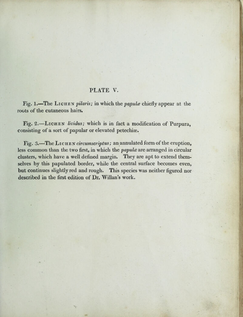 Fig. 1.—The Lichen pilaris; in which the papula chiefly appear at the roots of the cutaneous hairs. Fig. 2.—Lichen lividus; which is in fact a modification of Purpura, consisting of a sort of papular or elevated petechiae. Fig. 3.—The Lichen circumscriptus; an annulated form of the eruption, less common than the two first, in which the papula are arranged in circular clusters, which have a well defined margin. They are apt to extend them- selves by this papulated border, while the central surface becomes even, but continues slightly red and rough. This species was neither figured nor described in the first edition of Dr. Willan’s work. v