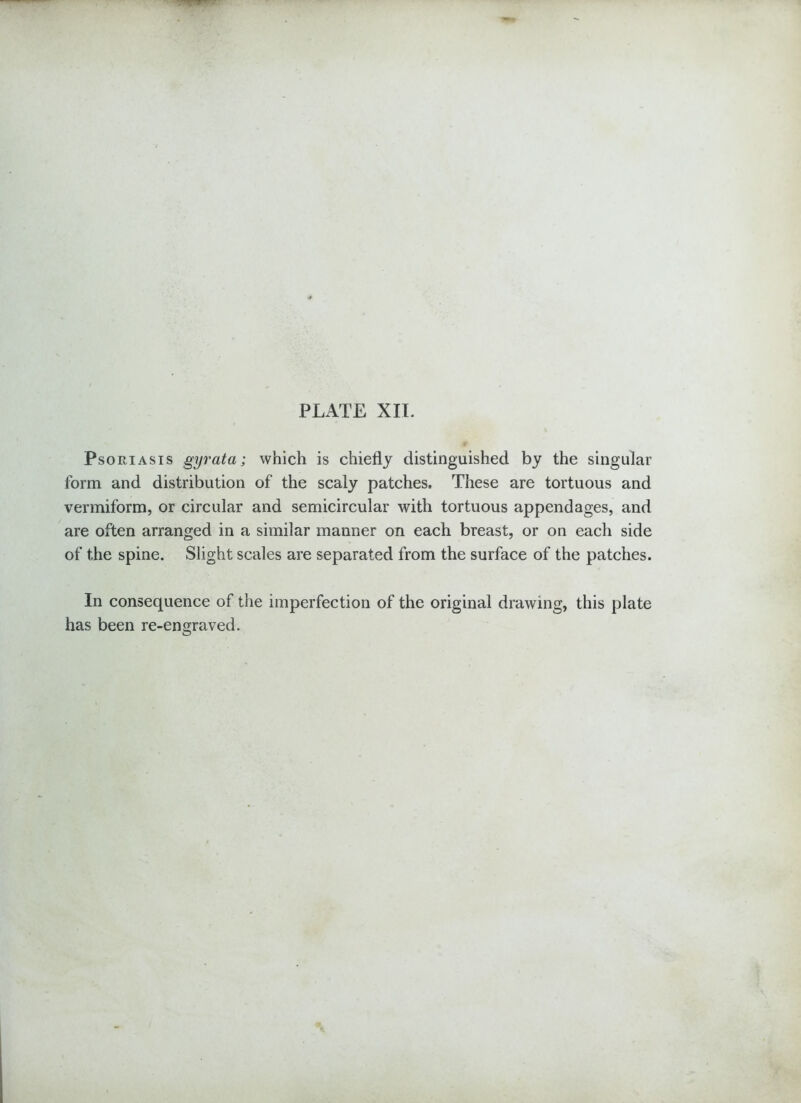 Psoriasis gyrata; which is chiefly distinguished by the singular form and distribution of the scaly patches. These are tortuous and vermiform, or circular and semicircular with tortuous appendages, and are often arranged in a similar manner on each breast, or on each side of the spine. Slight scales are separated from the surface of the patches. In consequence of the imperfection of the original drawing, this plate has been re-engraved.