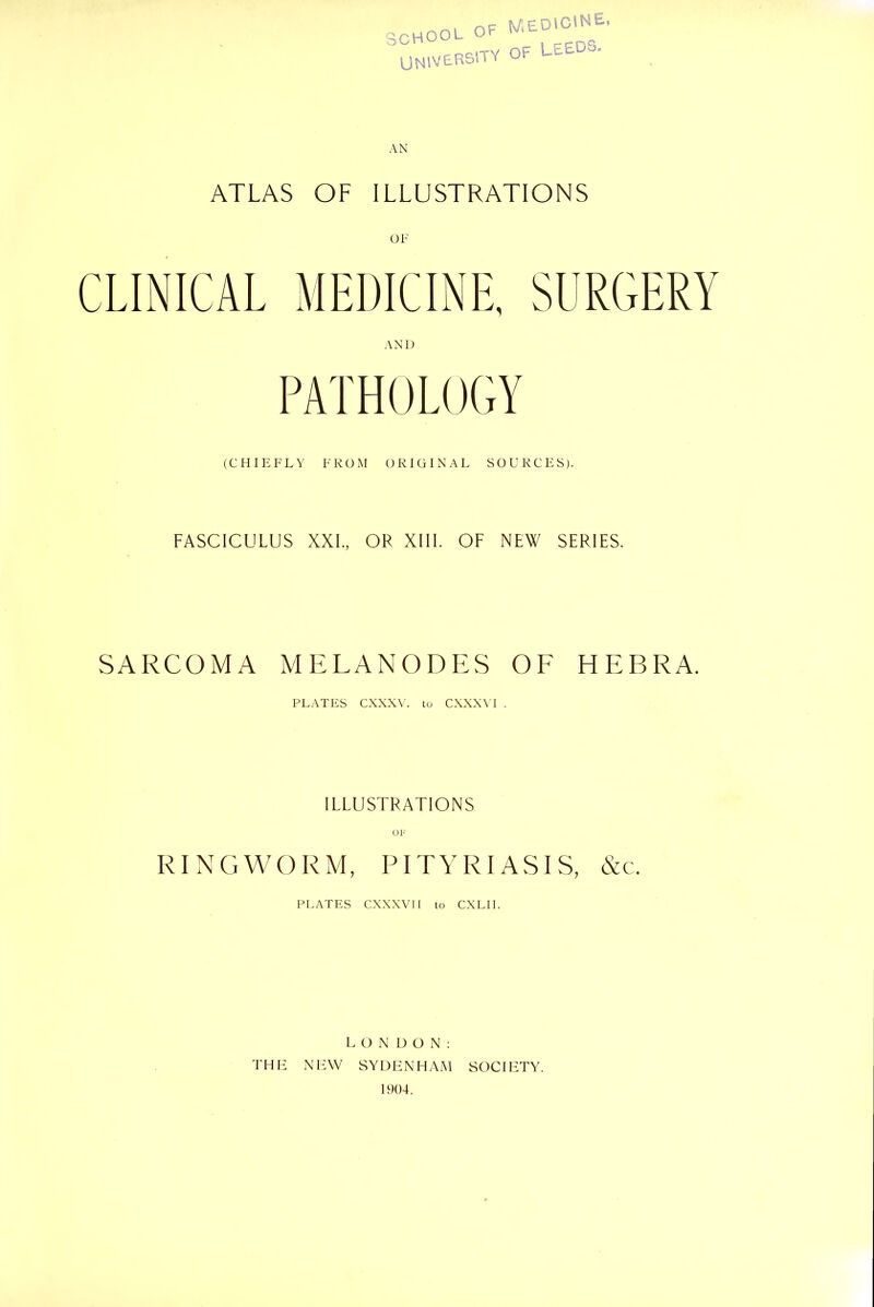 school OF medicine, UNIVERSITY OF LEEDS. ATLAS OF ILLUSTRATIONS OF CLINICAL MEDICINE, SURGERY AND PATHOLOGY (CHIEFLY FROM ORIGINAL SOURCES). FASCICULUS XXL, OR XIII. OF NEW SERIES. SARCOMA MELANODES OF HEBRA. PLATES CXXXV. to CXXXVI . ILLUSTRATIONS OF RINGWORM, PITYRIASIS, cYc. PLATES CXXXVI I to CXLII. LONDON: THE NEW SYDENHAM SOCIETY. 1904.