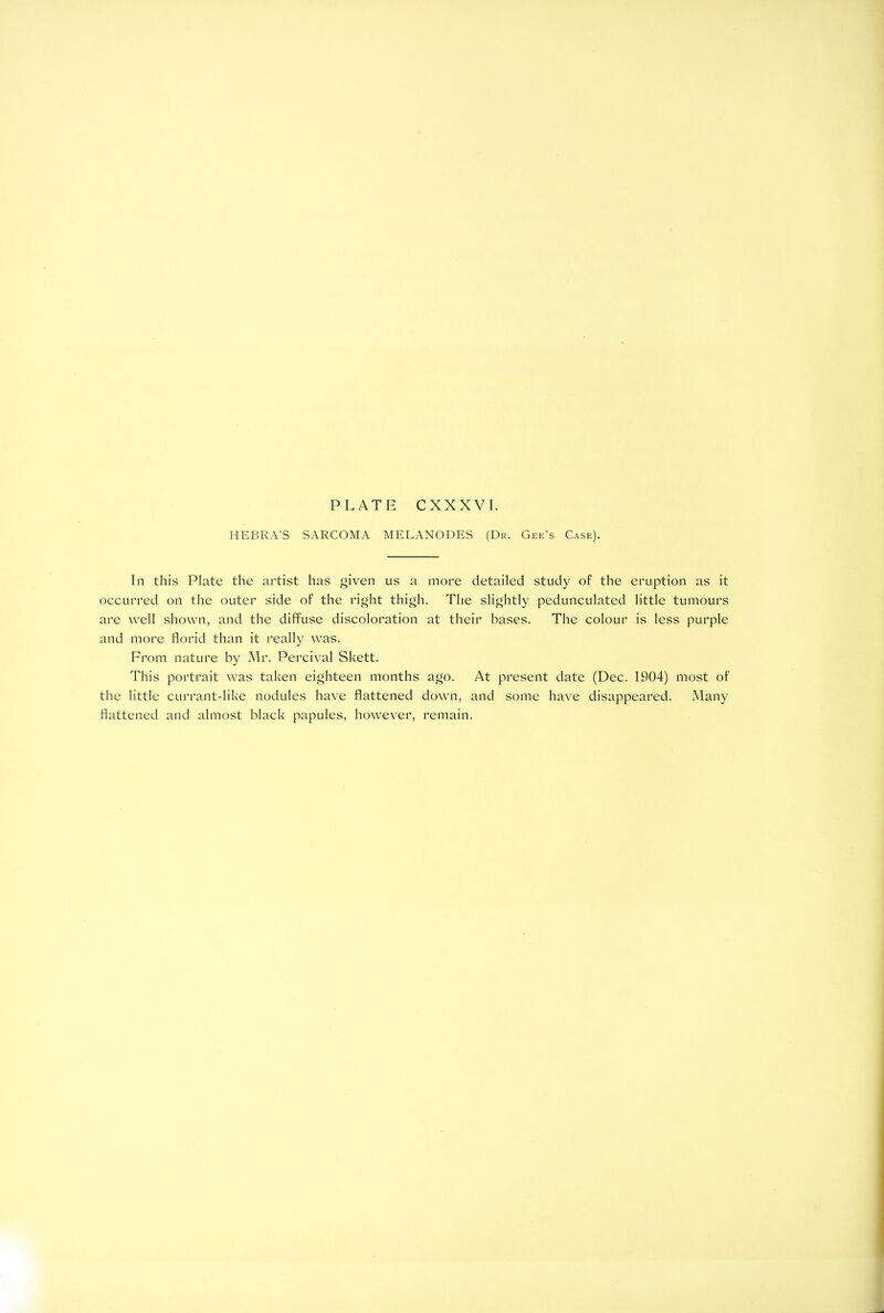 PLATE CXXXVI. HEBRA’S SARCOMA MELANODES (Dr. Gee’s Case). In this Plate the artist has given us a more detailed study of the eruption as it occurred on the outer side of the right thigh. The slightly pedunculated little tumours are well shown, and the diffuse discoloration at their bases. The colour is less purple and more florid than it really was. From nature by Mr. Percival Skett. This portrait was taken eighteen months ago. At present date (Dec. 1904) most of the little currant-like nodules have flattened down, and some have disappeared. Many flattened and almost black papules, however, remain.