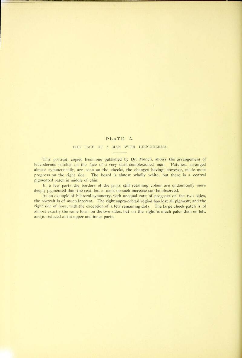 THE FACE OF A MAN WITH LEUCODERMA. This portrait, copied from one published by Dr. Munch, shows the arrangement of leucodermic patches on the face of a very dark-complexioned man. Patches, arranged almost symmetrically, are seen on the cheeks, the changes having, however, made most progress on the right side. The beard is almost wholly white, hut there is a central pigmented patch in middle of chin. In a few parts the borders of the parts still retaining colour are undoubtedly more deeply pigmented than the rest, but in most no such increase can he observed. As an example of bilateral symmetry, with unequal rate of progress on the two sides, the portrait is of much interest. The right supra-orbital region has lost all pigment, and the right side of nose, with the exception of a few remaining dots. The large cheek-patch is of almost exactly the same form on the two sides, hut on the right is much paler than on left, and is reduced at its upper and inner parts.