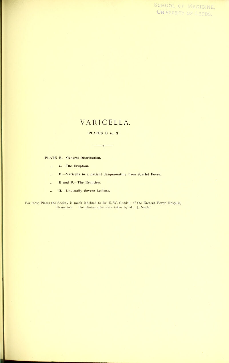 SCHOOL OF Mi University of VARICELLA. PLATES B to G. PLATE B. General Distribution. ,, C. The Eruption. ,, D.—Varicella in a patient desquamating from Scarlet Fever. ,, E and F.—The Eruption. ,, G. -Unusually Severe Lesions. For these Plates the Society is much indebted to Dr. E. W. Goodall, of the Eastern Fever Hospital, Homerton. The photographs were taken by Mr. J. Neale. i