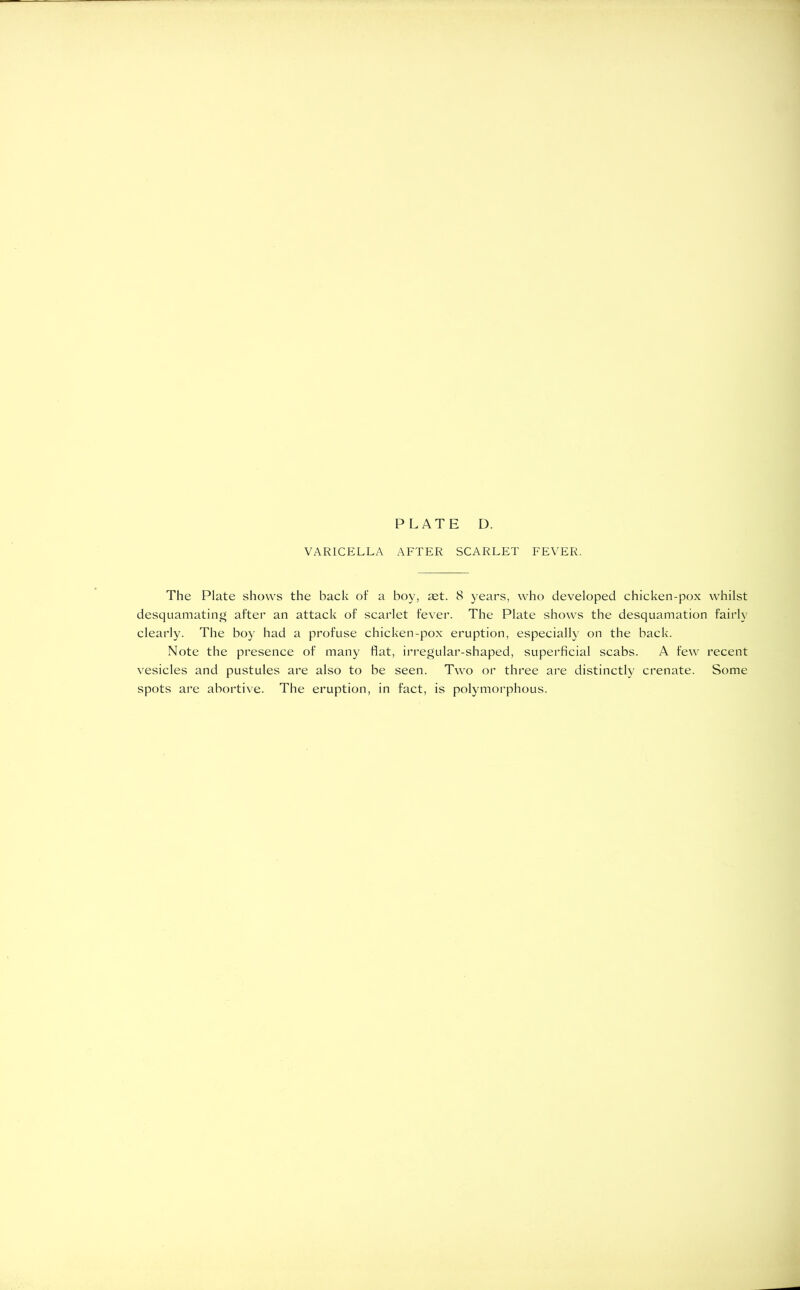VARICELLA AFTER SCARLET FEVER. The Plate shows the back of a boy, set. 8 years, who developed chicken-pox whilst desquamating after an attack of scarlet fever. The Plate shows the desquamation fairly clearly. The boy had a profuse chicken-pox eruption, especially on the back. Note the presence of many flat, irregular-shaped, superficial scabs. A few recent vesicles and pustules are also to be seen. Two or three are distinctly crenate. Some spots are abortive. The eruption, in fact, is polymorphous.
