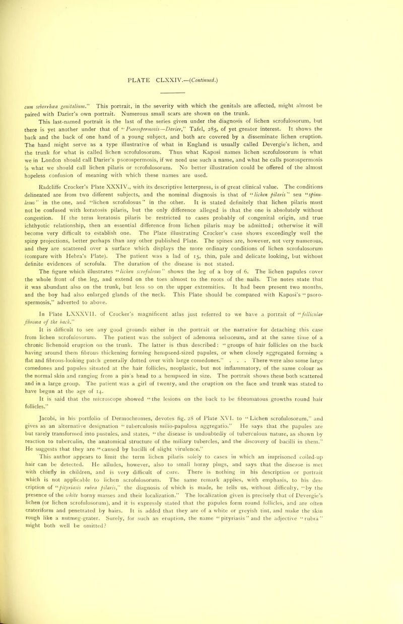 cum seborrhcea genitalium. This portrait, in the severity with which the genitals are affected, might almost be paired with Darier’s own portrait. Numerous small scars are shown on the trunk. This last-named portrait is the last of the series given under the diagnosis of lichen scrofulosorum, but there is yet another under that of “ Psorospermosis—Darier,” Tafel, 285, of yet greater interest. It shows the back and the back of one hand of a young subject, and both are covered by a disseminate lichen eruption. The hand might serve as a type illustrative of what in England is usually called Devergie’s lichen, and the trunk for what is called lichen scrofulosorum. Thus what Kaposi names lichen scrofulosorum is what we in London should call Darier’s psorospermosis, if we need use such a name, and what he calls psorospermosis is what we should call lichen pilaris or scrofulosorum. No better illustration could be offered of the almost hopeless confusion of meaning with which these names are used. Radcliffe Crocker’s Plate XXXIV., with its descriptive letterpress, is of great clinical value. The conditions delineated are from two different subjects, and the nominal diagnosis is that of “ lichen pilaris ” seu “spinu- losus in the one, and “lichen scrofulosus ” in the other. It is stated definitely that lichen pilaris must not be confused with keratosis pilaris, but the only difference alleged is that the one is absolutely without congestion. If the term keratosis pilaris be restricted to cases probably of congenital origin, and true ichthyotic relationship, then an essential difference from lichen pilaris may be admitted; otherwise it will become very difficult to establish one. The Plate illustrating Crocker’s case shows exceedingly well the spiny projections, better perhaps than any other published Plate. The spines are, however, not very numerous, and they are scattered over a surface which displays the more ordinary conditions of lichen scrofulosorum (compare with Hebra’s Plate). The patient was a lad of 15, thin, pale and delicate looking, but without definite evidences of scrofula. The duration of the disease is not stated. The figure which illustrates “lichen scrofulosus shows the leg of a boy of 6. The lichen papules cover the whole front of the leg, and extend on the toes almost to the roots of the nails. The notes state that it was abundant also on the trunk, but less so on the upper extremities. It had been present two months, and the boy had also enlarged glands of the neck. This Plate should be compared with Kaposi’s “ psoro- spermosis,” adverted to above. In Plate LXXXVII. of Crocker’s magnificent atlas just referred to we have a portrait of “follicular fibroma of the back. It is difficult to see any good grounds either in the portrait or the narrative for detaching this case from lichen scrofulosorum. The patient was the subject of adenoma sebaceum, and at the same time of a chronic lichenoid eruption on the trunk. The latter is thus described : “ groups of hair follicles on the back having around them fibrous thickening forming hempseed-sized papules, or when closely aggregated forming a flat and fibrous-looking patch generally dotted over with large comedones.” . . . There were also some large comedones and papules situated at the hair follicles, neoplastic, but not inflammatory, of the same colour as the normal skin and ranging from a pin’s head to a hempseed in size. The portrait shows these both scattered and in a large group. The patient was a girl of twenty, and the eruption on the face and trunk was stated to have begun at the age of 14. It is said that the microscope showed “ the lesions on the back to be fibromatous growths round hair follicles.” Jacobi, in his portfolio of Dermochromes, devotes fig. 28 of Plate XVI. to “Lichen scrofulosorum,” and gives as an alternative designation “ tuberculosis milio-papulosa aggregatio.” He says that the papules are but rarely transformed into pustules, and states, “ the disease is undoubtedly of tuberculous nature, as shown by reaction to tuberculin, the anatomical structure of the miliary tubercles, and the discovery of bacilli in them.” He suggests that they are “caused by bacilli of slight virulence.” This author appears to limit the term lichen pilaris solely to cases in which an imprisoned coiled-up hair can be detected. He alludes, however, also to small horny plugs, and says that the disease is met with chiefly in children, and is very difficult of cure. There is nothing in his description or portrait which is not applicable to lichen scrofulosorum. The same remark applies, with emphasis, to his des- cription of “pityriasis rubra pilaris, the diagnosis of which is made, he tells us, without difficulty, “by the presence of the white horny masses and their localization.” The localization given is precisely that of Devergie’s lichen (or lichen scrofulosorum), and it is expressly stated that the papules form round follicles, and are often crateriform and penetrated by hairs. It is added that they are of a white or greyish tint, and make the skin rough like a nutmeg-grater. Surely, for such an eruption, the name “ pityriasis ” and the adjective “rubra” might both well be omitted?