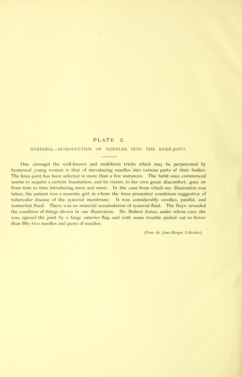 HYSTERIA.—INTRODUCTION OF NEEDLES INTO THE KNEE-JOINT. One amongst the well-known and multiform tricks which may be perpetrated by hysterical young women is that of introducing needles into various parts of their bodies. The knee-joint has been selected in more than a few instances. The habit once commenced seems to acquire a certain fascination, and its victim, to her own great discomfort, goes on from time to time introducing more and more. In the case from which our illustration was taken, the patient was a neurotic girl, in whom the knee presented conditions suggestive of tubercular disease of the synovial membrane. It was considerably swollen, painful, and somewhat fixed. There was no material accumulation of synovial fluid. The Rays revealed the condition of things shown in our illustration. Mr. Robert Jones, under whose care she was, opened the joint by a large anterior flap, and with some trouble picked out no fewer than fifty-two needles and parts of needles.