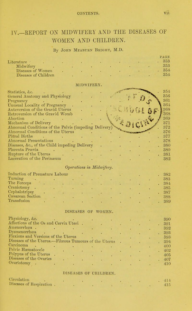 lY.—REPORT ON MIDWIFERr AND THE DISEASES OF WOMEN AND CHILDREN. By John Meabuen Bright, M.D. PAGE Literature ....... 353 Midwifery ...... 353 Diseases of Women ...... 354 Diseases of Children .... 354 MIDWIFERY. Statistics, &c. .... , T'»''^'*'*'*°7r**''*'^ General Anatomy and Physiology . ' /. . 356 Pregnancy . . . . ..' .*«* \ 361 Unusual Locality of Pregnancy . . ... . . \ 364 Anteversion of the Gravid Uterus . . ;. l,-if f> j (V l^* V^^^ Retroversion of the Gravid Womb . ^ . ' . ^  f SeS Abortion . . . . \ '-'j:'. . ^^.s^ / 369 Mechanism of Delivery . . X lil 1 {* ^ / Abnormal Conditions of the Pelvis (impeding Delivery) ** S V * . 372 Abnormal Conditions of the Uterus . . ^t^orw^w***^ 376 Plural Births . . . , . . .377 Abnormal Presentations ..... 378 Diseases, &c., of the Child impeding Delivery .... 380 Placenta Pra2via ...... 380 Eupture of the Uterus ...... 381 Laceration of the Perinseum ..... 382 Operations in Midvtnfery. Induction of Premature Labour ..... 382 Turning ....... 383 The Forceps ....... 384 Craniotomy . . . . . . . 385 Cephalotripsy ....... 387 Cajsarean Section . . . ' . . . 388 Transfusion ....... 389 DISEASES OE WOMEN. Physiology, &c. ..... . 390 Affections of the Os and Cervix Uteri ..... 391 Amenorrhoea ....... 392 Dysmenorrhoea ....... 393 Flexions and Versions of the Uterus .... 393 Diseases of the Uterus.—Fibrous Tumours of the Uterus . . . 394 Carcinoma . . . . . . .400 Pelvic Ha3matocele ...... 402 Polypus of the Uterus ...... 405 Diseases of the Ovaries ...... 407 Ovariotomy ....... 410 DISEASES OF CHILDllEN. Circulation ....... Ill Diseases of Kespiration ...... 415