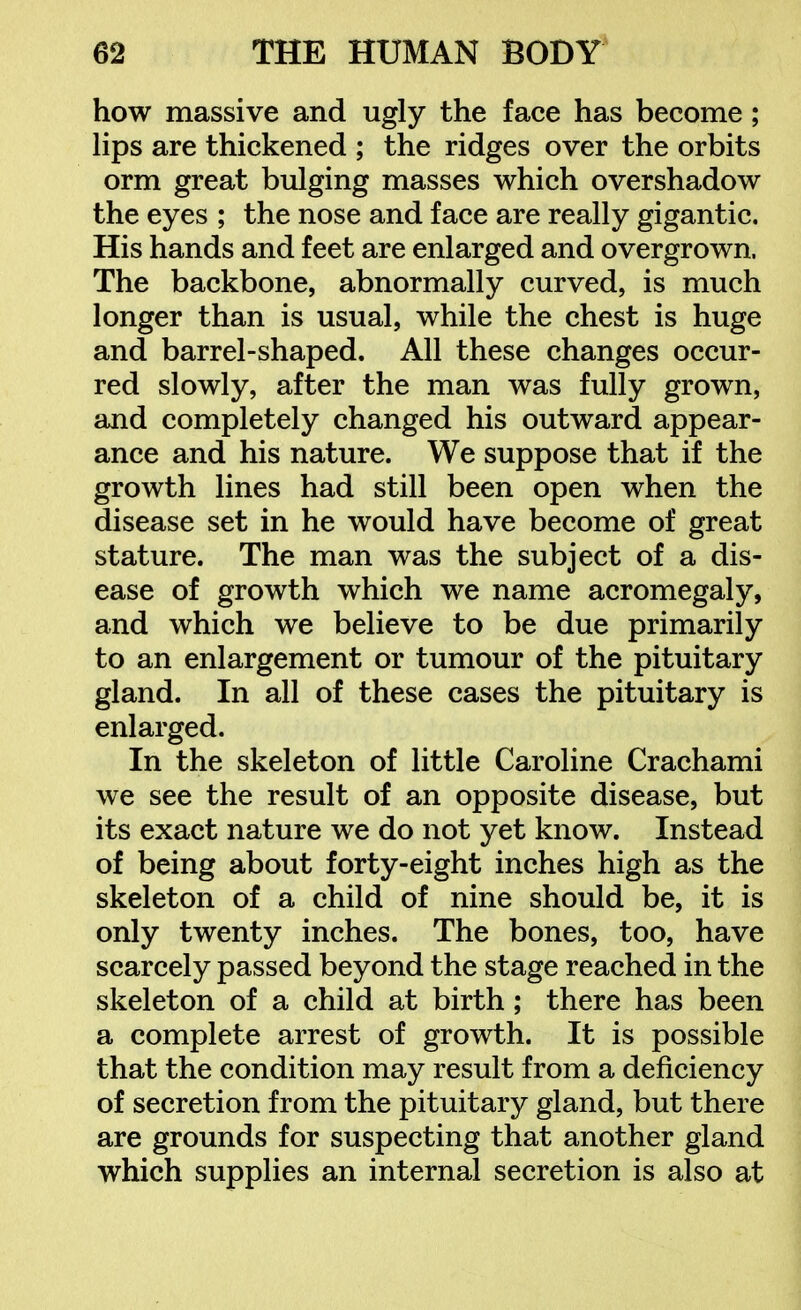 how massive and ugly the face has become; lips are thickened ; the ridges over the orbits orm great bulging masses which overshadow the eyes ; the nose and face are really gigantic. His hands and feet are enlarged and overgrown. The backbone, abnormally curved, is much longer than is usual, while the chest is huge and barrel-shaped. All these changes occur- red slowly, after the man was fully grown, and completely changed his outward appear- ance and his nature. We suppose that if the growth lines had still been open when the disease set in he would have become of great stature. The man was the subject of a dis- ease of growth which we name acromegaly, and which we believe to be due primarily to an enlargement or tumour of the pituitary gland. In all of these cases the pituitary is enlarged. In the skeleton of little Caroline Crachami we see the result of an opposite disease, but its exact nature we do not yet know. Instead of being about forty-eight inches high as the skeleton of a child of nine should be, it is only twenty inches. The bones, too, have scarcely passed beyond the stage reached in the skeleton of a child at birth; there has been a complete arrest of growth. It is possible that the condition may result from a deficiency of secretion from the pituitary gland, but there are grounds for suspecting that another gland which supplies an internal secretion is also at