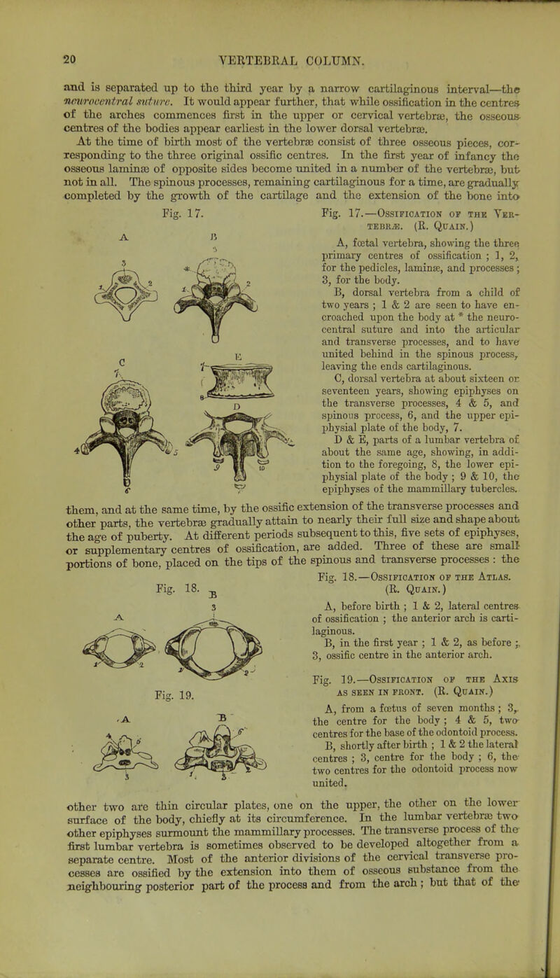 A and is separated up to the third year by a narrow cartilaginous interval—the nmiroeentral suture. It would appear further, that while ossification in the centres of the arches commences first in the upper or cervical vertebrae, the osseous- centres of the bodies appear earliest in the lower dorsal vertebrae. At the time of birth most of the vertebrae consist of three osseous pieces, cor- responding to the three original ossific centres. In the first year of infancy the osseous laminae of opposite sides become united in a number of the vertebrae, but not in all. The spinous processes, remaining cartilaginous for a time, are gradually completed by the growth of the cartilage and the extension of the bone into Fig. 17. Fig. 17.—Ossification op the Ver- tebra. (R. Quain.) A, foetal vertebra, showing the three primary centres of ossification ; 1, 2, for the pedicles, laminae, and processes; 3, for the body. B, dorsal vertebra from a child of two years ; 1 & 2 are seen to have en- croached upon the body at * the neuro- central suture and into the articular and transverse processes, and to have united behind in the spinous process, leaving the ends cartilaginous. C, dorsal vertebra at about sixteen or seventeen years, showing epiphyses on the transverse processes, 4 & 5, and spinous process, 6, and the upper ejji- physial plate of the body, 7. D & E, parts of a lumbar vertebra of about the same age, showing, in addi- tion to the foregoing, 8, the lower epi- physial plate of the body ; 9 & 10, the epiphyses of the mammillary tubercles. them, and at the same time, by the ossific extension of the transverse processes and other parts, the vertebrae gradually attain to nearly their full size and shape about the age of puberty. At different periods subsequent to this, five sets of epiphyses, or supplementary centres of ossification, are added. Three of these are small- portions of bone, placed on the tips of the spinous and transverse processes : the Fig. 18.—Ossification of the Atlas. (R. Quain.) A, before birth ; 1 & 2, lateral centres of ossification ; the anterior arch is carti- laginous. B, in the first year ; 1 & 2, as before 3, ossific centre in the anterior arch. Fig Fig. 19. 19.—Ossification of the Axis AS SEEN IN FRONT. (R. QuAIN.) A, from a foetus of seven months ; 3,. the centre for the body ; 4 & 5, two- centres for the base of the odontoid process. B, shortly after birth ; 1 & 2 the lateral centres ; 3, centre for the body ; 6, the two centres for the odontoid process now- united. other two are thin circular plates, one on the upper, the other on the lower surface of the body, chiefly at its circumference. In the lumbar vertebra two other epiphyses surmount the mammillary processes. The transverse process of the first lumbar vertebra is sometimes observed to be developed altogether from a separate centre. Most of the anterior divisions of the cervical transverse pro- cesses are ossified by the extension into them of osseous substance from the neighbouring posterior part of the process and from the arch ; but that of the