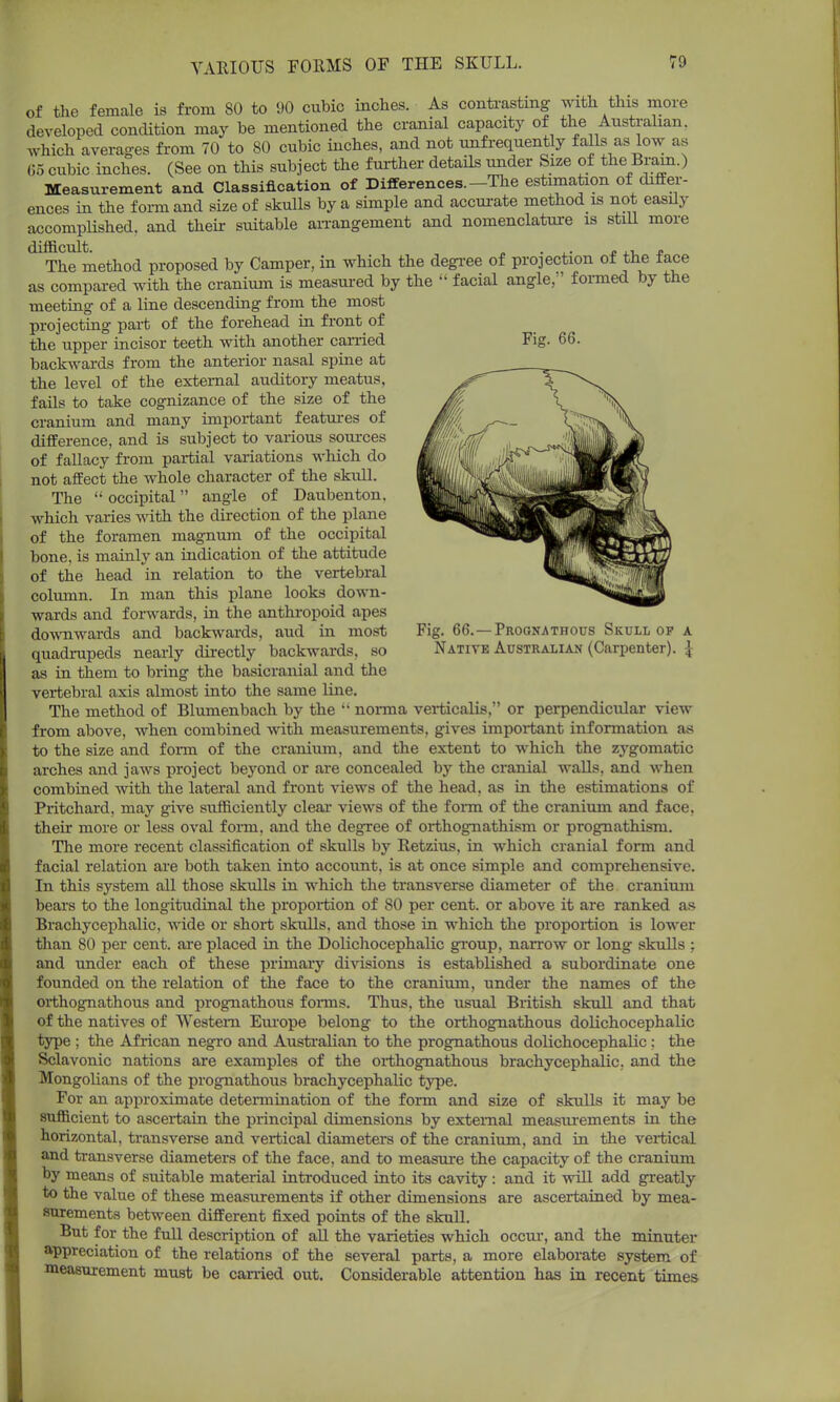 of the female is from 80 to 90 cubic inches. As contrasting with this more developed condition may be mentioned the cranial capacity of the Australian, which averages from 70 to 80 cubic inches, and not unfrequently falls as low as 05 cubic inches. (See on this subject the further details under Size of the Bram.) Measurement and Classification of Differences.-The estimation of differ- ences in the form and size of skulls by a simple and accurate method is not easily accomplished, and their suitable arrangement and nomenclature is stall more difficult. ' „ . J* .i n The method proposed by Camper, in which the degree of projection of the face as compared with the cranium is measured by the  facial angle,' formed by the meeting of a line descending from the most projecting part of the forehead in front of the upper incisor teeth with another carried Fig. 66. backwards from the anterior nasal spine at the level of the external auditory meatus, fails to take cognizance of the size of the cranium and many important features of difference, and is subject to various sources of fallacy from partial variations which do not affect the whole character of the skull. The  occipital angle of Daubenton. which varies with the direction of the plane of the foramen magnum of the occipital bone, is mainly an indication of the attitude of the head in relation to the vertebral column. In man this plane looks down- wards and forwards, in the anthropoid apes downwards and backwards, aud in most Fig. 66.—Prognathous Skull op a quadrupeds nearly directly backwards, so Native Australian (Carpenter). % as in them to bring the basicranial and the vertebral axis almost into the same line. The method of Blumenbach by the  norma verticalis, or perpendicular view from above, when combined with measurements, gives important information as to the size and form of the cranium, and the extent to which the zygomatic arches and jaws project beyond or are concealed by the cranial walls, and when combined with the lateral and front views of the head, as in the estimations of Pritchard, may give sufficiently clear views of the form of the cranium and face, their more or less oval form, and the degree of orthognathism or prognathism. The more recent classification of skulls by Retzius, in which cranial form and facial relation are both taken into account, is at once simple and comprehensive. In this system all those skulls in which the transverse diameter of the cranium bears to the longitudinal the proportion of 80 per cent, or above it are ranked as Brachycephalic, wide or short skulls, and those in which the proportion is lower than 80 per cent, are placed in the Dolichocephalic group, narrow or long skulls ; and under each of these primary divisions is established a subordinate one founded on the relation of the face to the cranium, under the names of the orthognathous and prognathous forms. Thus, the usual British skull and that of the natives of Western Europe belong to the orthognathous dolichocephalic type ; the African negro and Australian to the prognathous dolichocephalic: the Sclavonic nations are examples of the orthognathous brachycephalic, and the Mongolians of the prognathous brachycephalic type. For an approximate determination of the form and size of skulls it may be sufficient to ascertain the principal dimensions by external measurements in the horizontal, transverse and vertical diameters of the cranium, and in the vertical and transverse diameters of the face, and to measure the capacity of the cranium by means of suitable material introduced into its cavity: and it will add greatly to the value of these measurements if other dimensions are ascertained by mea- surements between different fixed points of the skull. But for the full description of all the varieties which occur, and the minuter appreciation of the relations of the several parts, a more elaborate system of measurement must be carried out. Considerable attention has in recent times