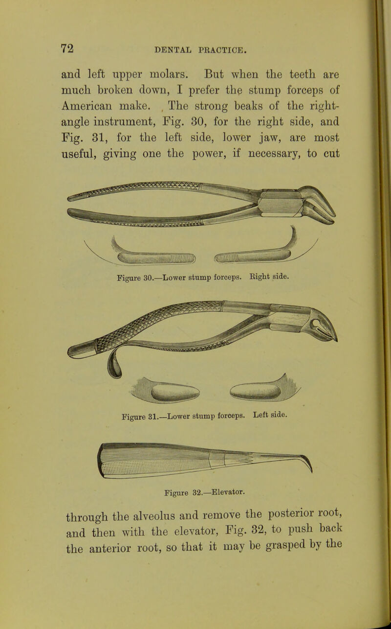 and left upper molars. But when the teeth are much broken down, I prefer the stump forceps of American make. , The strong beaks of the right- angle instrument, Fig. 30, for the right side, and Fig. 31, for the left side, lower jaw, are most useful, giving one the power, if necessary, to cut Figure 30.—Lower stump forceps. Eight side. Figure 31.—Lower stump forceps. Left side. Figure 32.—Elevator. through the alveolus and remove the posterior root, and then with the elevator, Fig. 32, to push back the anterior root, so that it may be grasped by the