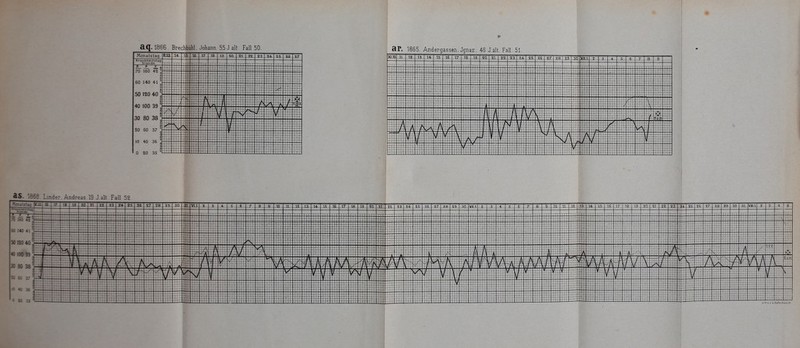 aq. 1866. BrechbüM, Johann. 55 J alt. Fall 50. X1.10 cir. 1865. Andergassen, Jgnaz. 46 J.alt. Fall. 51. 12__13^ 14 17 18. 9.Ö1 9.TT 9.9. 23 24. .26 27 28: 23. 3D XIL1 1868- Lmder. Andreas 19 J.alt Fall 52 1 ilLJ M I I I I— sc 2L _22.. 23 I 24- J25 26 27 2S_ 2a_ -303/11 ja .14. 15- je. izl ja__ia 24. 23. 30 .16. .12. .1S.J2Q 22 23 Ii IG VIII. 1. 1 ■ | - --t—H-f: I 11 I i ITT Am