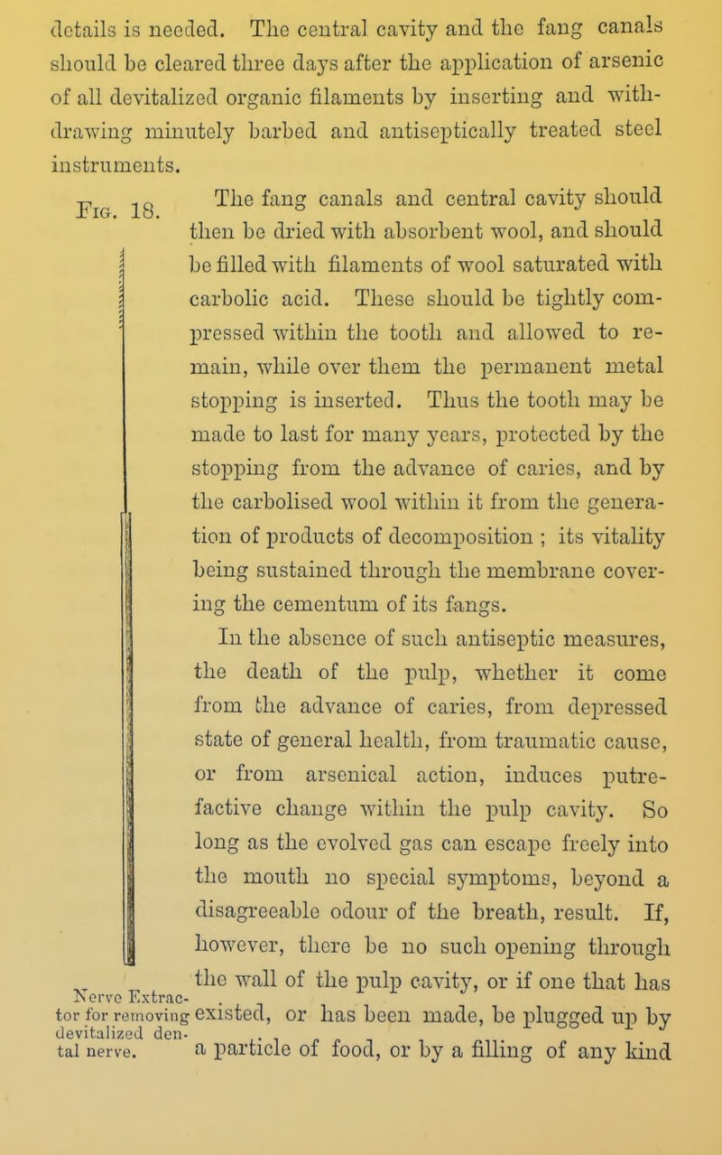 details is needed. The central cavity and the fang canals should be cleared three days after the application of arsenic of all devitalized organic filaments by inserting and with- drawing minutely barbed and antiseptically treated steel instruments. Fig. 18. The fang canals and central cavity should then be dried with absorbent wool, and should be filled with filaments of wool saturated with carbolic acid. These should be tightly com- pressed within the tooth and allowed to re- main, while over them the permanent metal stopping is inserted. Thus the tooth may be made to last for many years, protected by the stopping from the advance of caries, and by the carbolised wool within it from the genera- tion of products of decomposition ; its vitality being sustained through the membrane cover- ing the cementum of its fangs. In the absence of such antiseptic measures, the death of the pulp, whether it come from the advance of caries, from depressed state of general health, from traumatic cause, or from arsenical action, induces putre- factive change within the pulp cavity. So long as the evolved gas can escape freely into the mouth no special symptoms, beyond a disagreeable odour of the breath, result. If, however, there be no such opening through the wall of the pulp cavity, or if one that has Is erve Extrac- tor for removing existed, or has been made, be plugged up by devitalized den- tal nerve. a particle of food, or by a filling of any kind