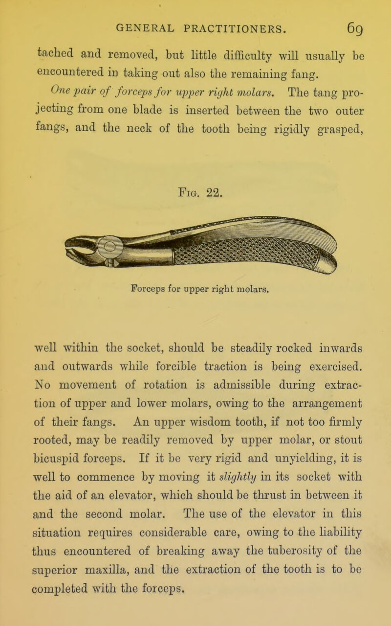 tached and removed, but little difficulty will usually be encountered in taking out also the remaining fang. One pair of forceps for upper right molars. The tang pro- jecting from one blade is inserted between the two outer fangs, and the neck of the tooth being rigidly grasped, Fig. 22. Forceps for upper right molars. well within the socket, should be steadily rocked inwards and outwards while forcible traction is being exercised. No movement of rotation is admissible during extrac- tion of upper and lower molars, owing to the arrangement of their fangs. An upper wisdom tooth, if not too firmly rooted, may be readily removed by upper molar, or stout bicuspid forceps. If it be very rigid and unyielding, it is well to commence by moving it slightly in its socket with the aid of an elevator, which should be thrust in between it and the second molar. The use of the elevator in this situation requires considerable care, owing to the liability thus encountered of breaking away the tuberosity of the superior maxilla, and the extraction of the tooth is to be completed with the forceps.